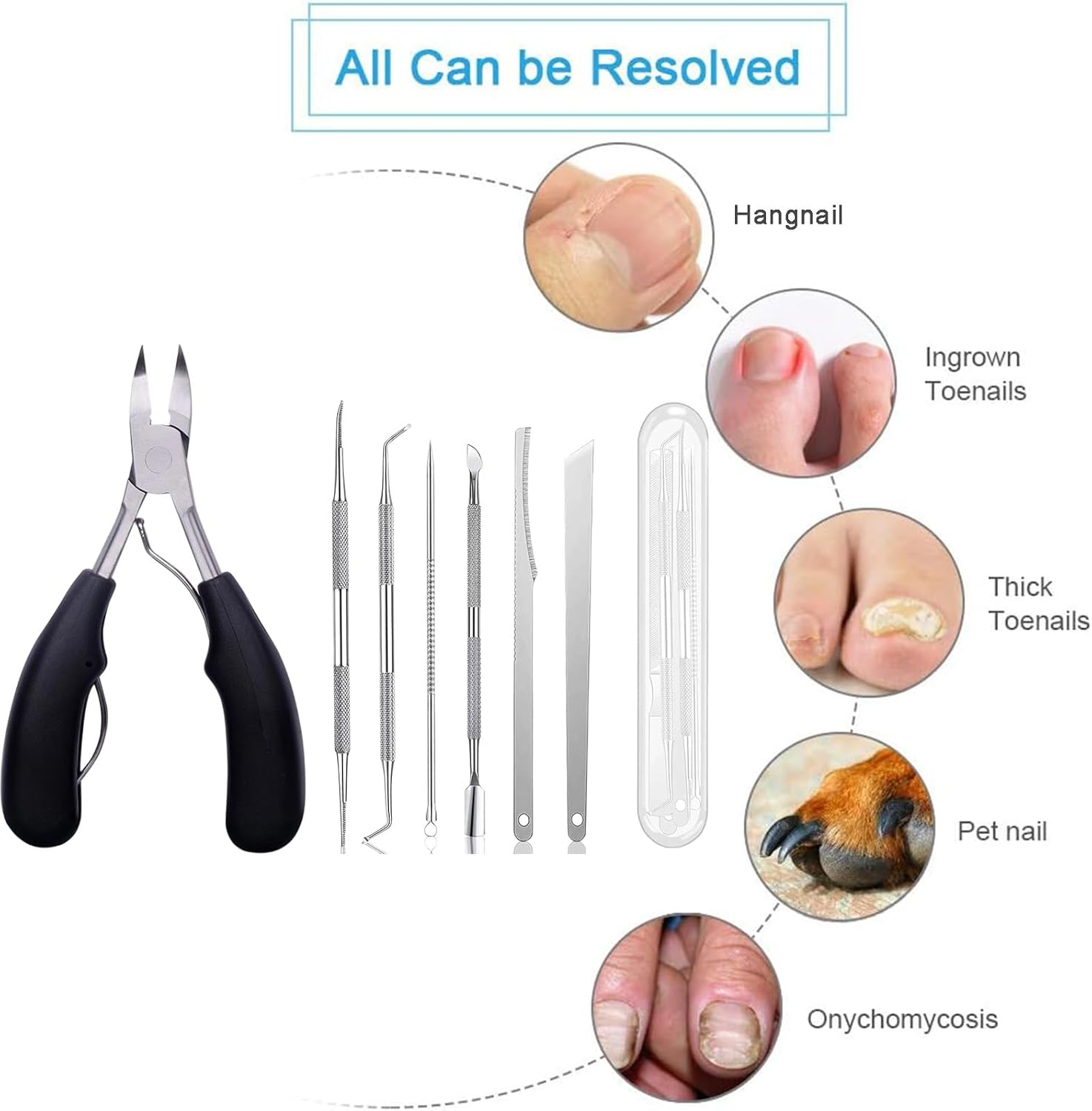 Ingrown Toenail Clippers, Professional Nail Clipper Set for Thick & Ingrown Nails, Stainless Steel Toe Nail Clippers with Long Handle, Suitable for Men and Women