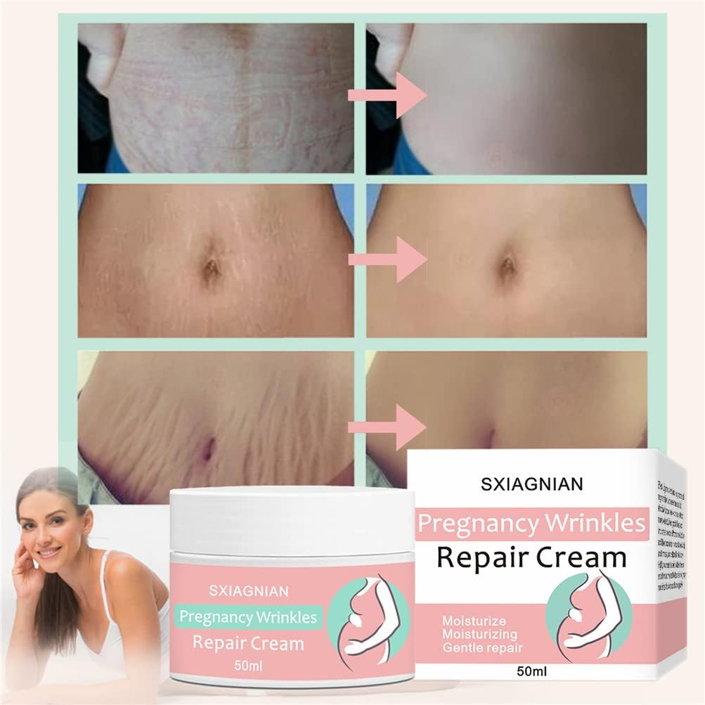 Organic Flawless Firming Cream Stretch Marks Fading Cream Stretch Marks Reversal Cream Stretch Marks Remover Cream Skin Care Treatment Cream for Stretch Mark Removal Maternity Slackline image number 1