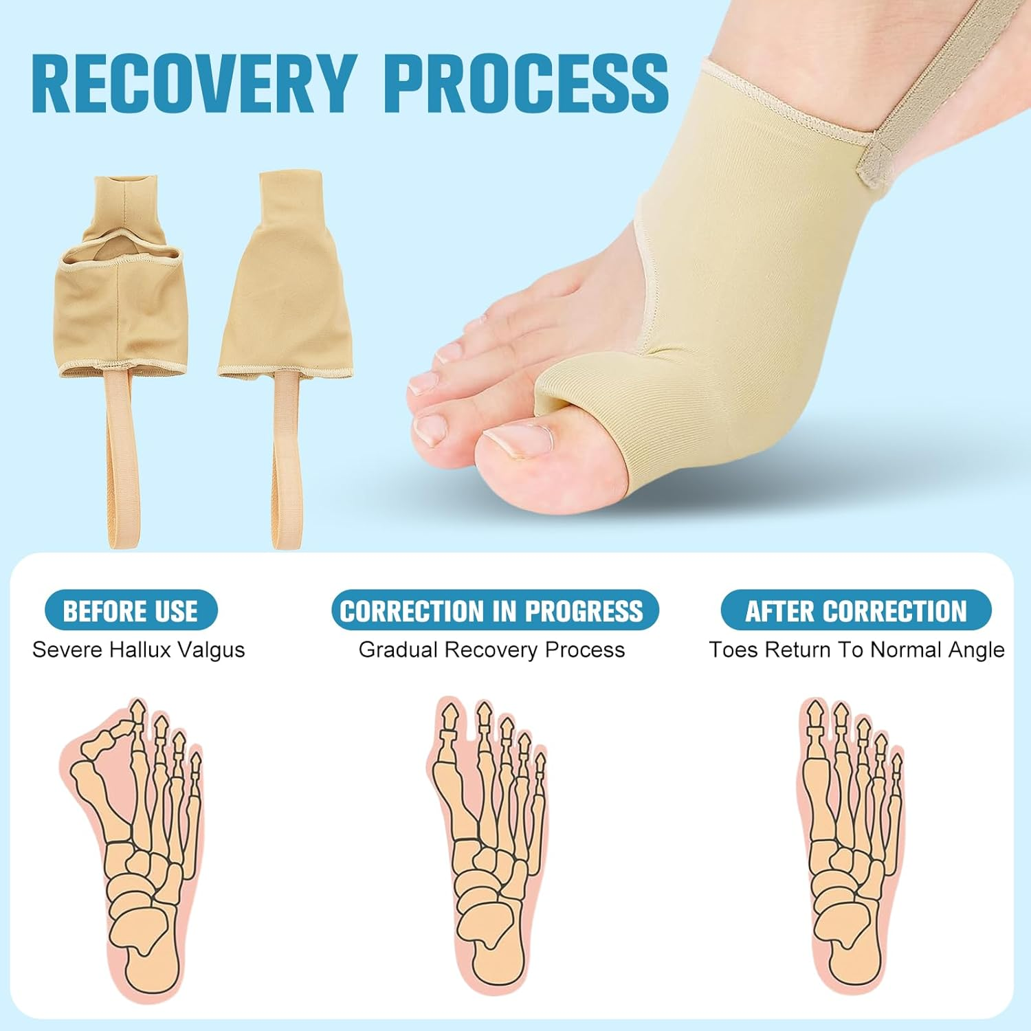 Bunion Corrector Sleeve for Women & Men - Big Toe Separators with Bunion Pads & Adjustable Foot Sleeve - Hallux Valgus Support & Discomfort Relief - Flexible Breathable Design for Day and Night Use (SKIN COLRO, M) image number 5