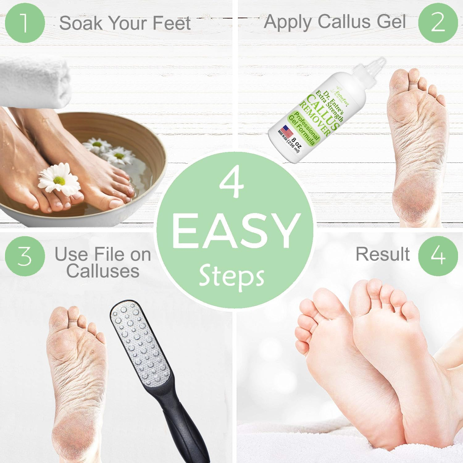Callus Remover Gel & Double-Sided Foot File: 8 Oz Extra Strength Callus Remover for Feet, Foot Callus Remover Care, Pedicure Tools Supplies, Spa Kit, Dead Skin Scrubber image number 6