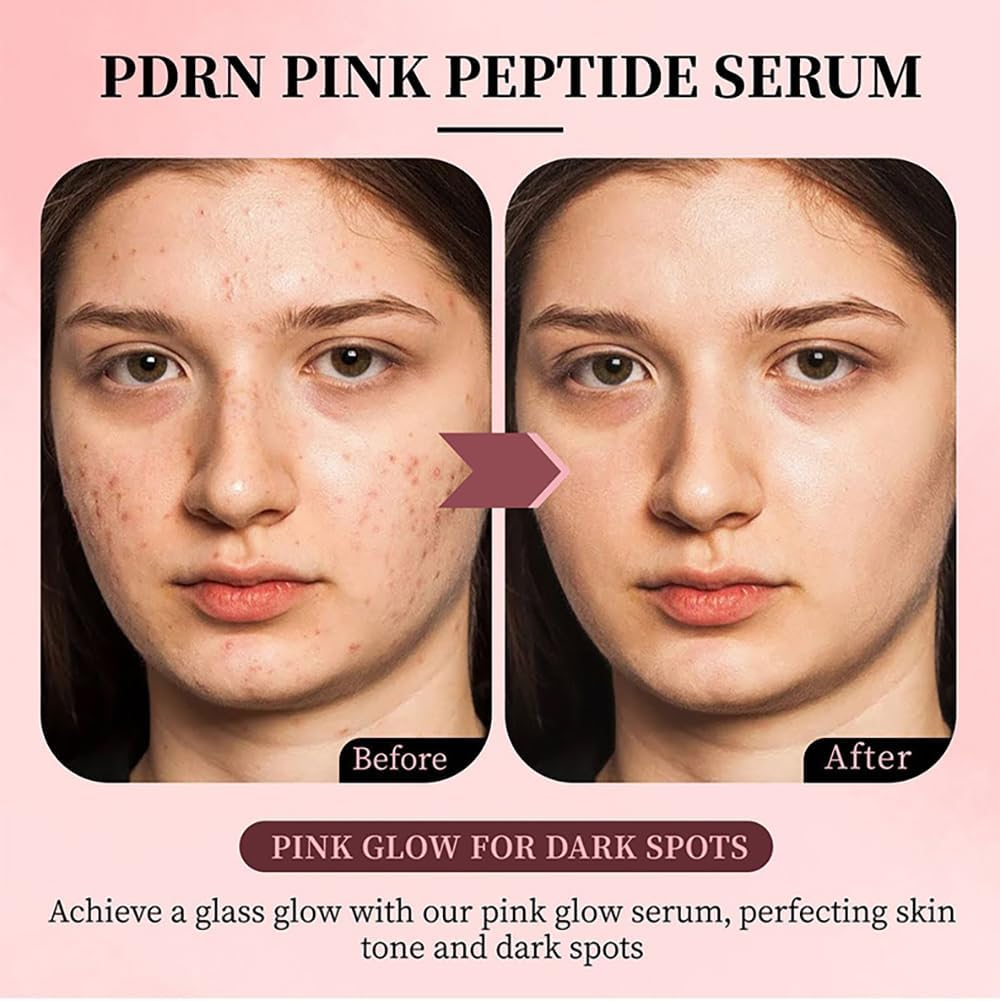Pink Peptide 12 PDRN Serum with Salmon DNA PDRN 10,320Ppm 12 Peptides Niacinamide for Skin Glow, Hydrating Moisturizing, Firming, Uneven Skin Tone, Korean Skincare(33Ml) image number 2