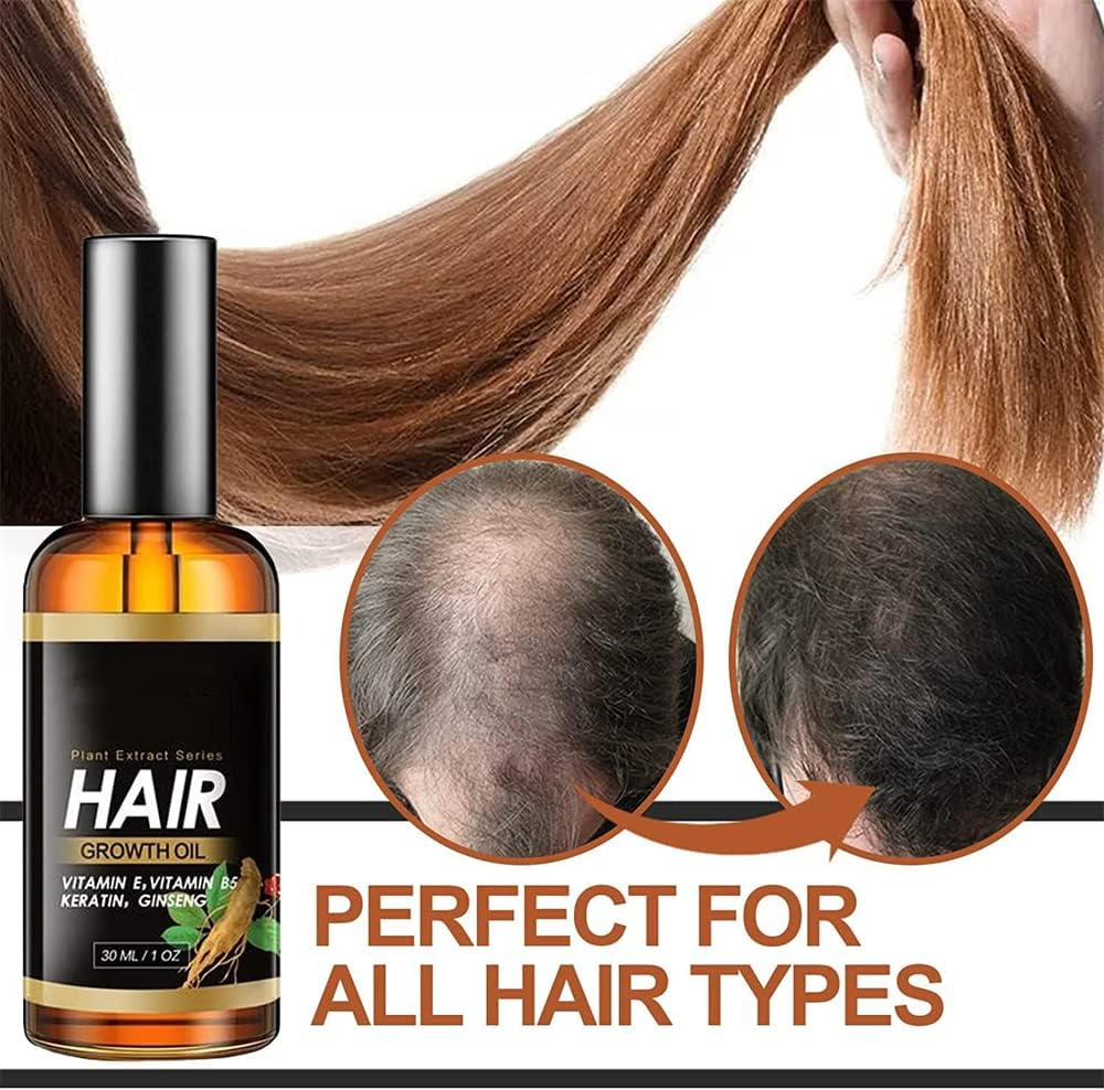 2Pcs Suna Plant Extract Hair Growth Oil,Ginger Germinal Essential Oil Hair Growth Hair Loss Treatment Hair Care Hair Growth Serum for Men & Women image number 2