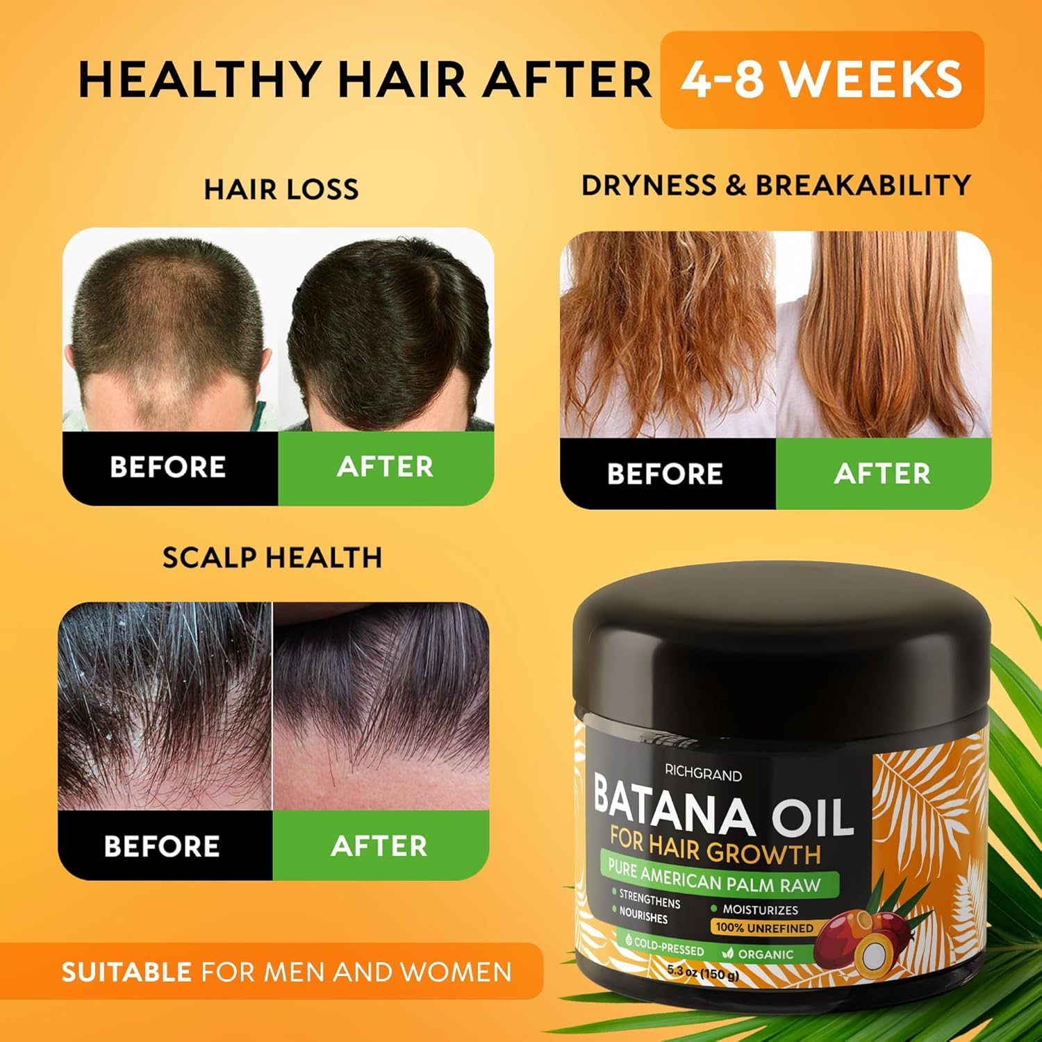 Batana Oil for Hair Growth - 100% Raw & Organic Dr Sebi Batana Oil - Cold-Pressed & Pure Unrefined Batana Hair Mask for Women & Men - Enhances Hair Thickness, Prevents Loss image number 1