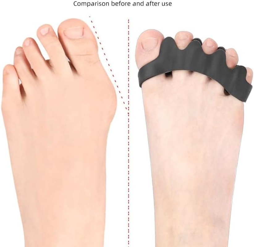 Five Hole Toe Divider, Thumb Eversion, Big Foot Bone Overlap, Toe Clamp, Orthotic Device, Toe Pad Adjustable Separator image number 1
