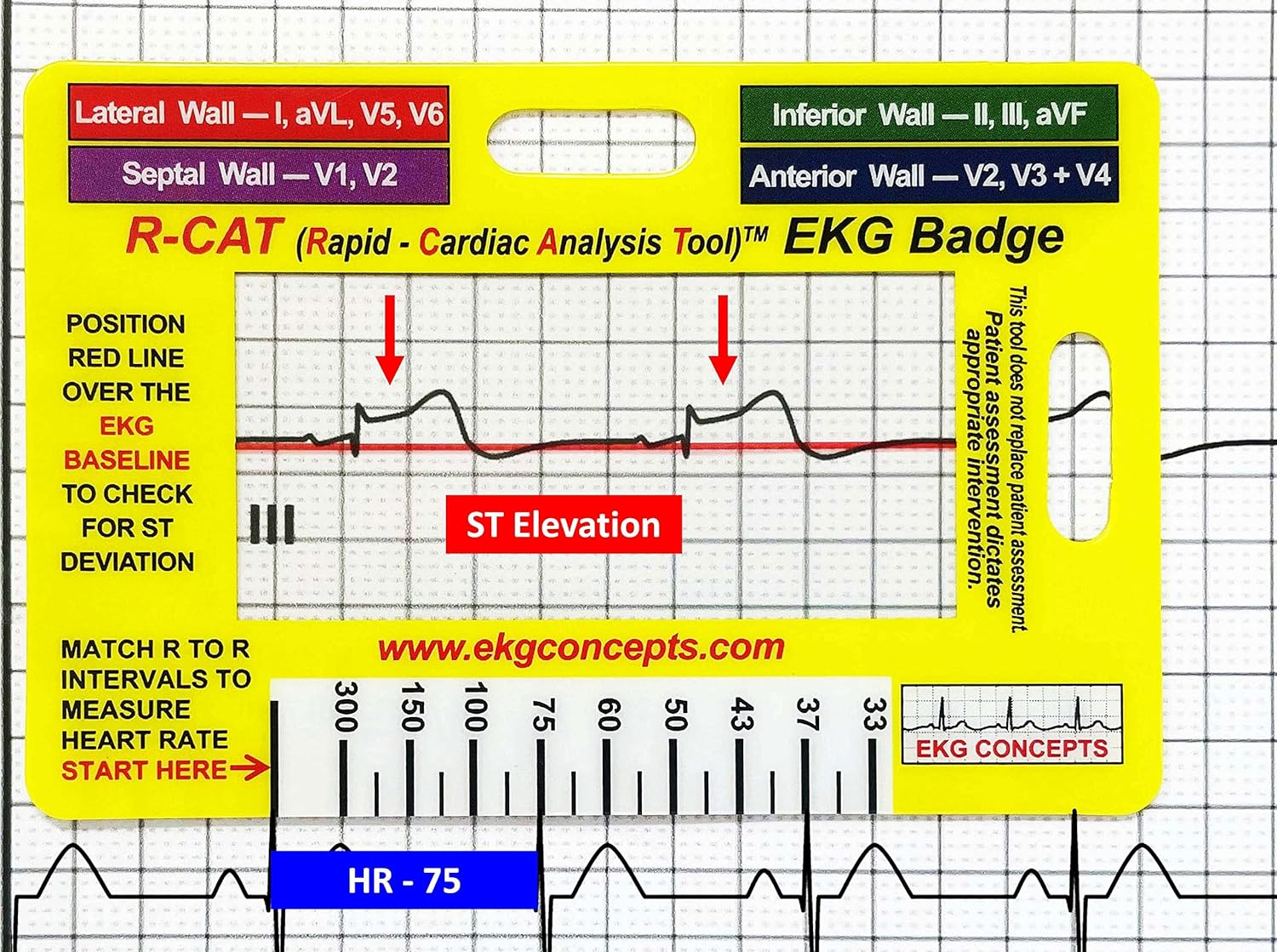 R-CAT EKG Badge image number 4