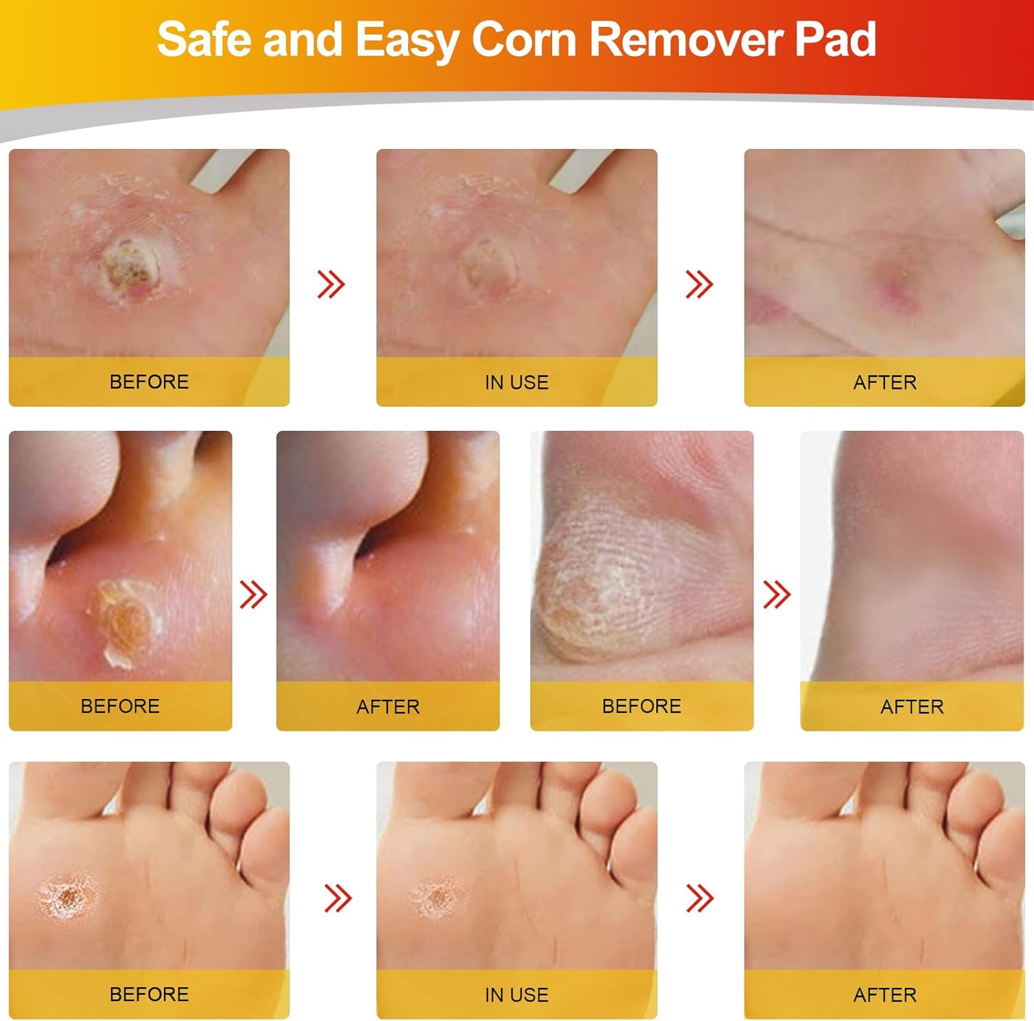 MYMULIKE Corn Removers for Feet, 24 Pack - 12 Large and 12 Small Sizes image number 3