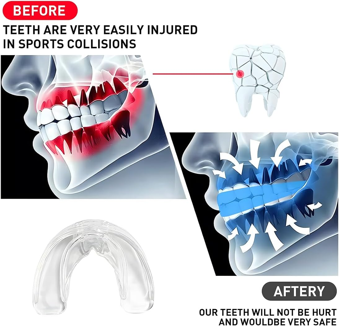 Pack of 3 Sports Mouth Guards, Sports Mouth Guards for Rugby, Boxing, Martial Arts, Hockey, MMA, Taekwondo and More, Adult image number 1