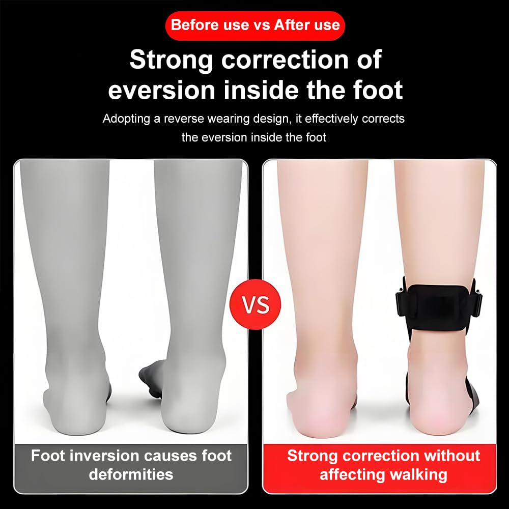 Plantar Fasciitis Night Splint,For Pain Relief Caused by Plantar Fasciitis Achilles Tendonitis Foot Drop Heel Spur Flat Arch, Unisex image number 4