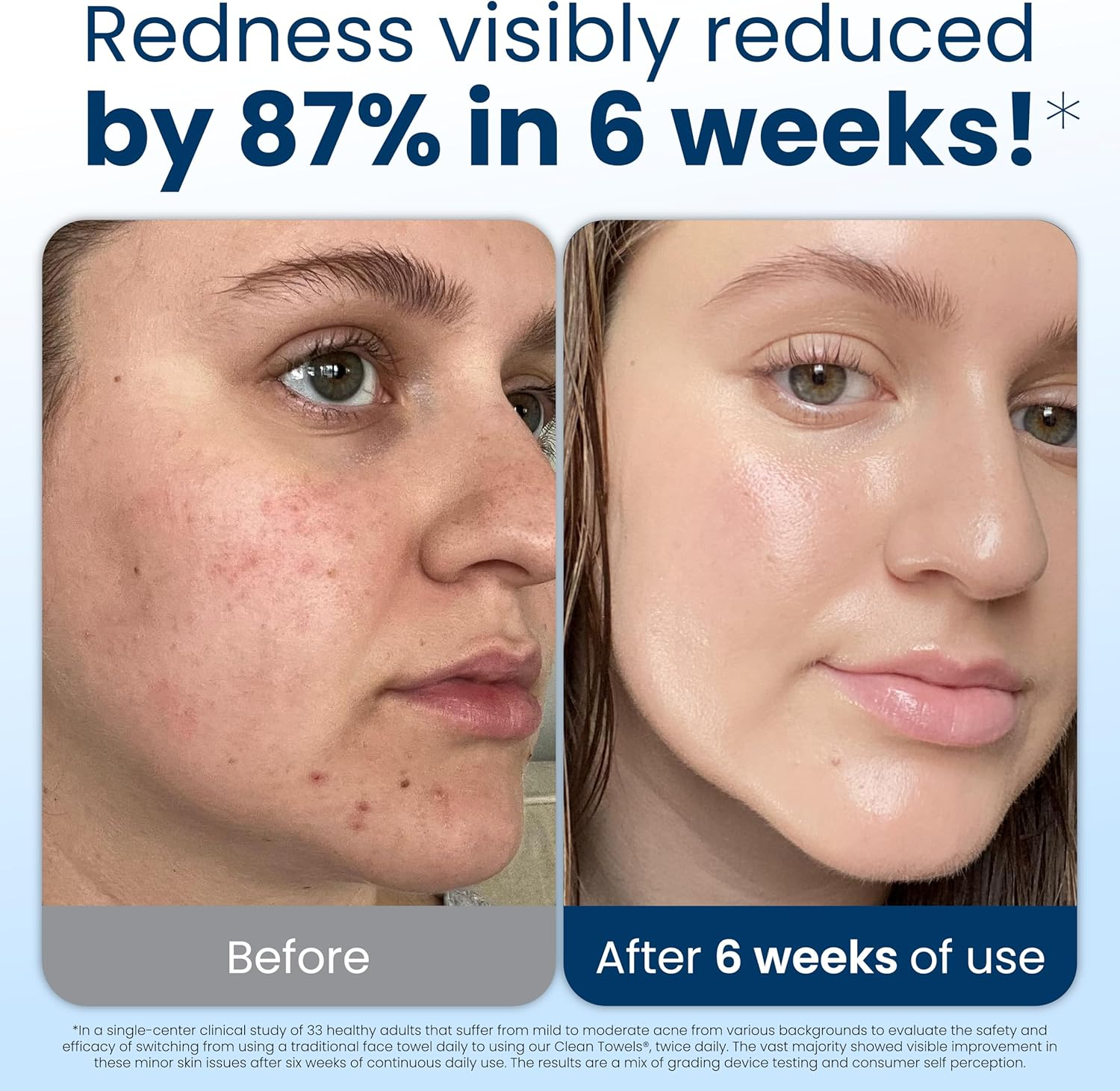 Clean Skin Club Clean Towels XL, 100% USDA Biobased, Clinically Tested Disposable Face Towel, Face Wash Cloth, Makeup Remover Dry Wipes, 3 Pack Travel Pack, 30 Ct image number 4