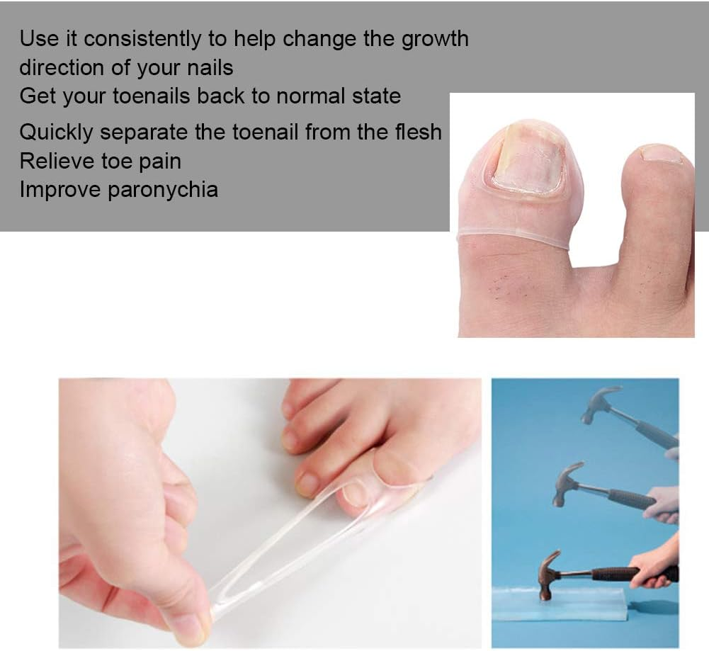Ingrown Toenail Treatment, Silicone Foot Toe Protector Caps Ingrown Toenail Correcting Tool Pain Relief Paronychia Treatment Corrector for Men Women Pedicure Recovering Healing image number 5