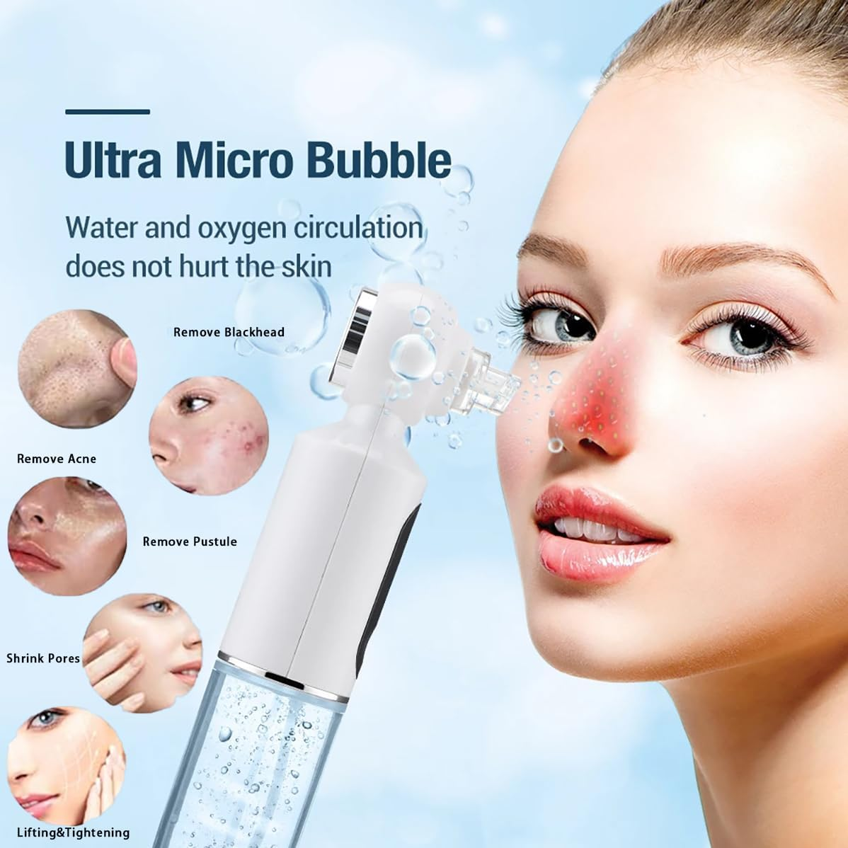 Blackhead Remover, Black Heads Remover with Hot Compress, 4 Adjustments Pore Vacuum Cleaner, Blackhead Vacuum with 6 Suction Cups, USB Charge, Pore Cleaner for Men & Women. image number 5