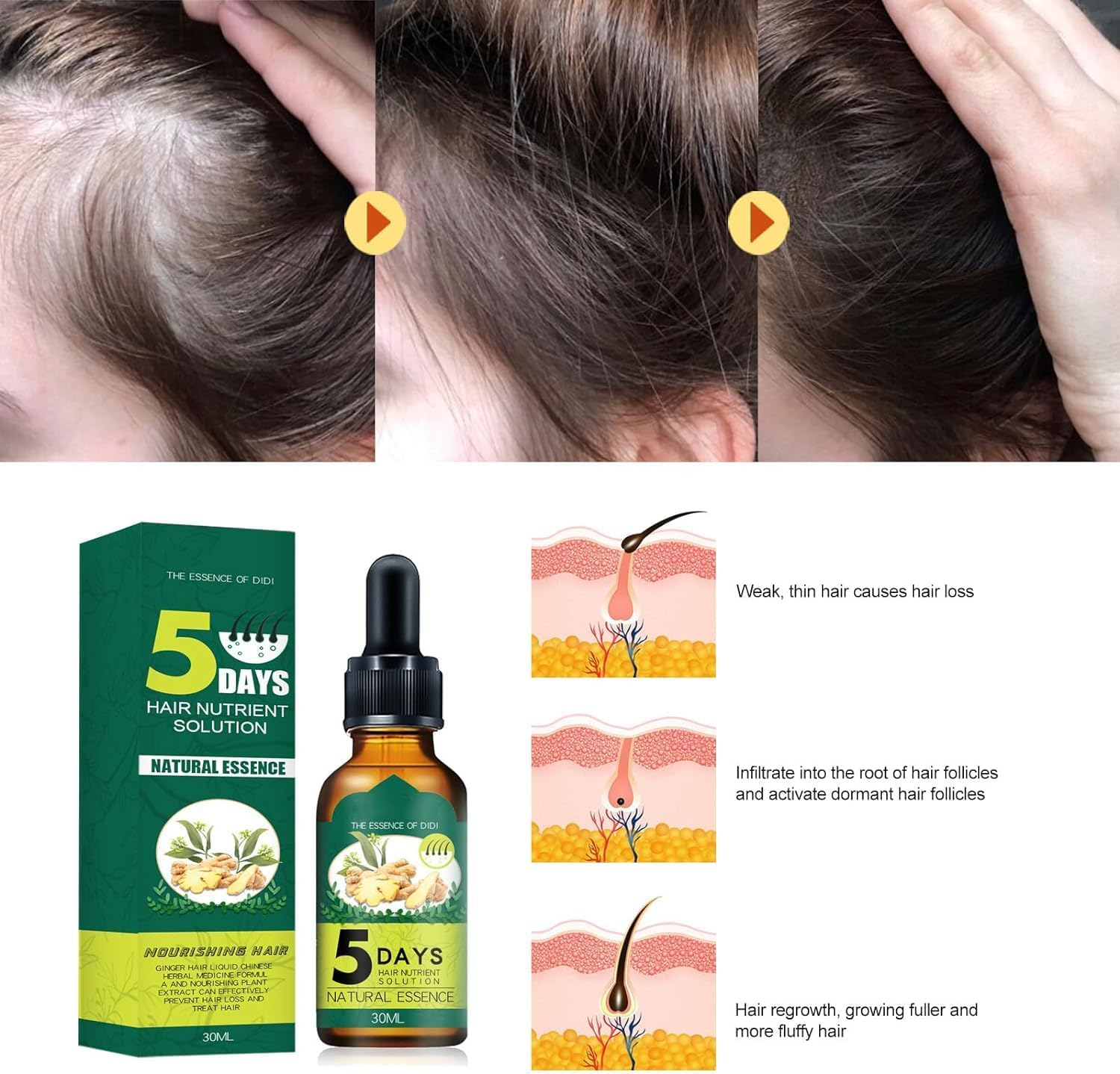 3 Pcs Prox Shouga Essence Hair Growth Oil,Prox Shouga Kingu Hair Growth Oil,5 Days Ginger Germinal Oil,Hair Oil for Growth and Anti-Hair Loss image number 1