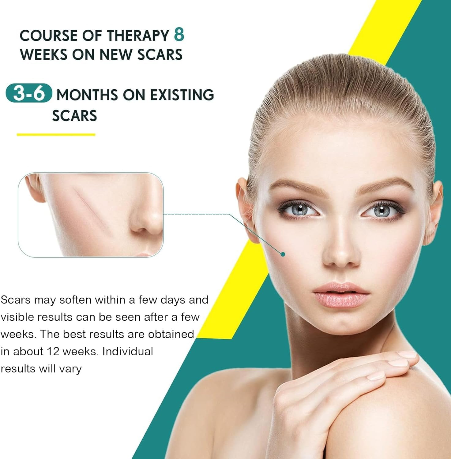 Silicone Scar Sheets, Silicone Scar Tape Roll, Scar Silicone Strips, Scar Removal Sheet Long Strips for Acne Burn, Keloid (4CM X 1.5M Roll)