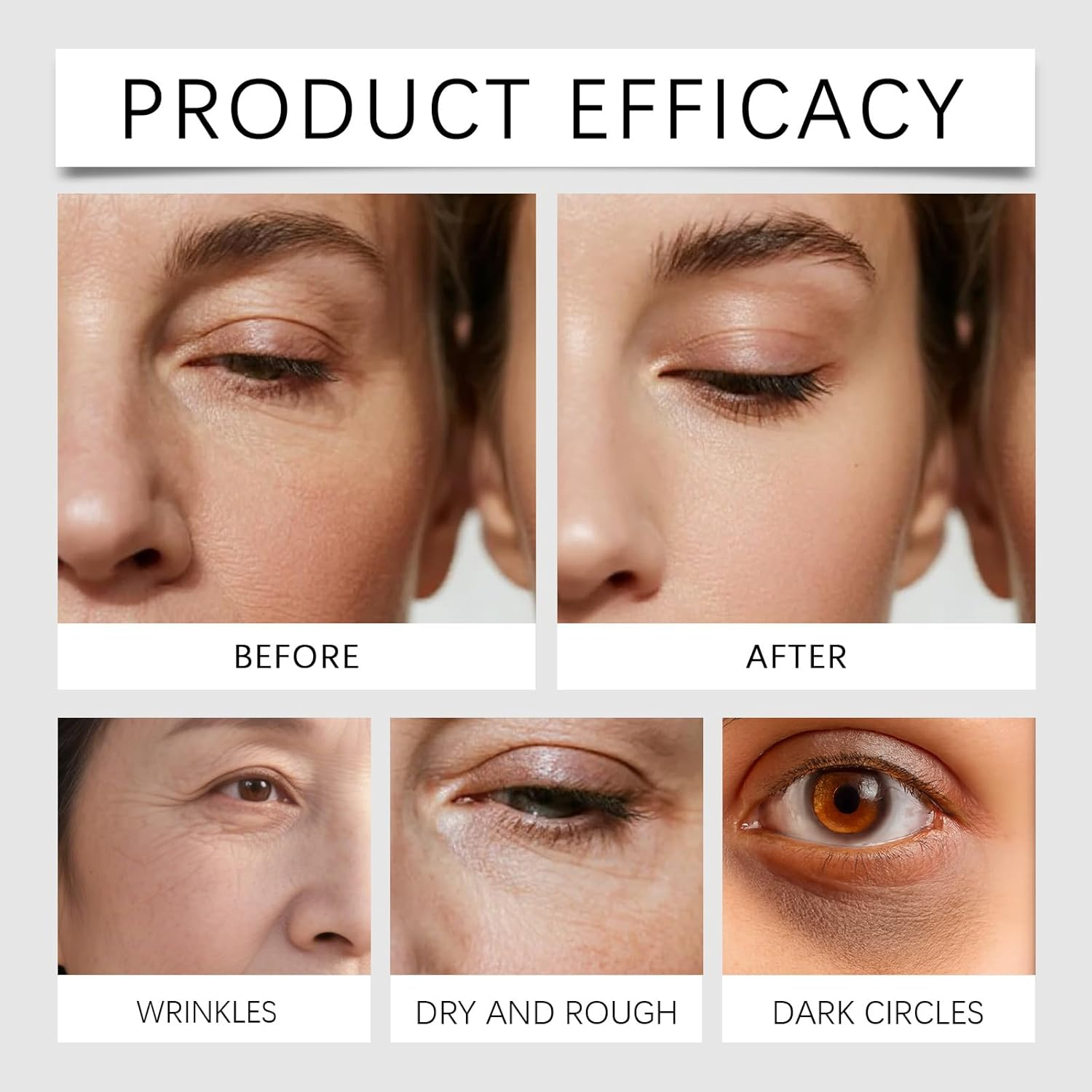 Calcium Volume Eye Patch, Firming under Eye Patches for Puffy Eyes & Dark Circles, Hydrating Soothing Gel Pads with Elastin, Anti-Aging Eye Mask for Fine Lines, Daily Eye Care for Smooth (1Pcs) - 2Pcs image number 6