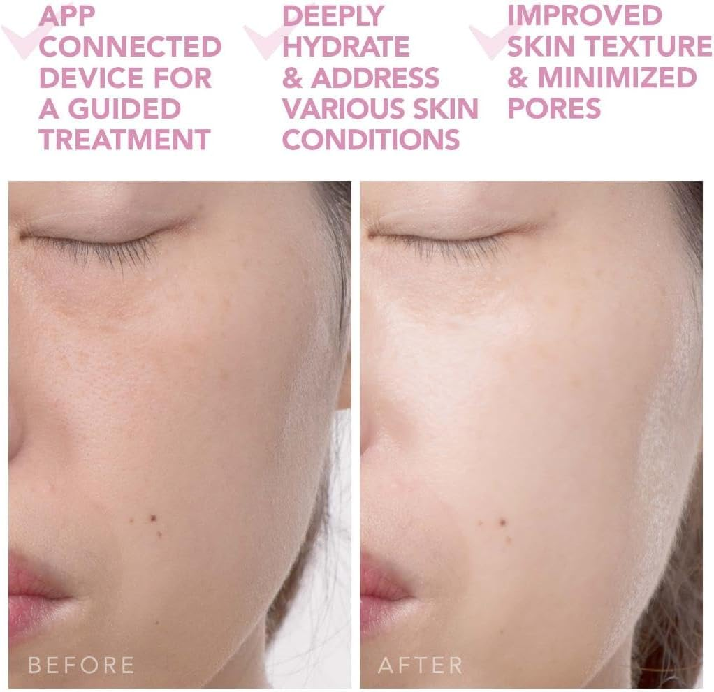 FOREO UFO 2 Supercharged Face Mask - Warming - Face Moisturizer - Dark Spot & Acne Scar Treatment for Face - anti Aging &ndash; Nourishing - Pearl Pink image number 3