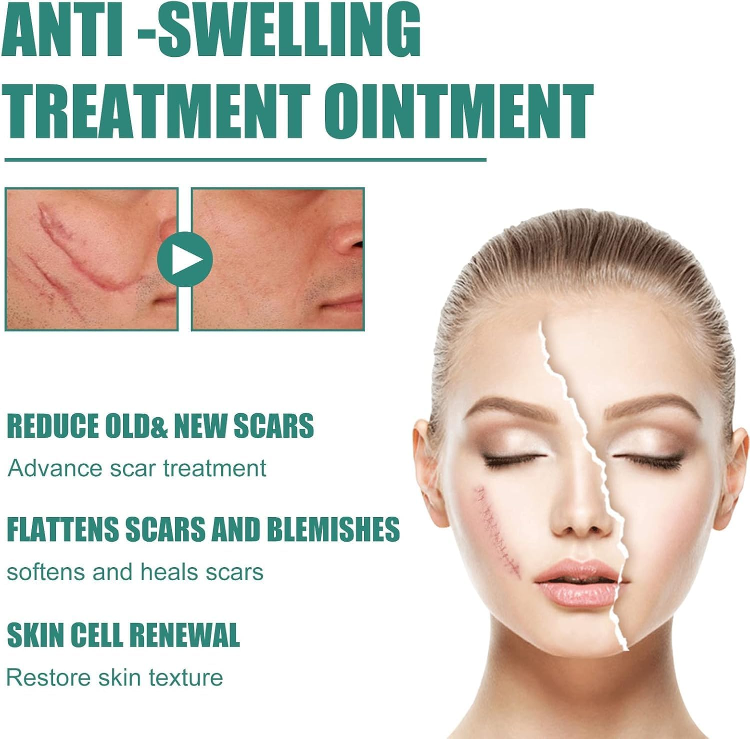 Organic Natural Tummy Leg Facial Scar Cream Pimples Stretch Marks Remove -Strong Effective Acne Scar Removal Cream,Lightweight Daily Moisturizer for Face & Body, Fast Absorbing, Non-Greasy Hydration, Gentle Skincare for All Skin Types &ndash; 50 Ml / 1.7 Fl Oz image number 4