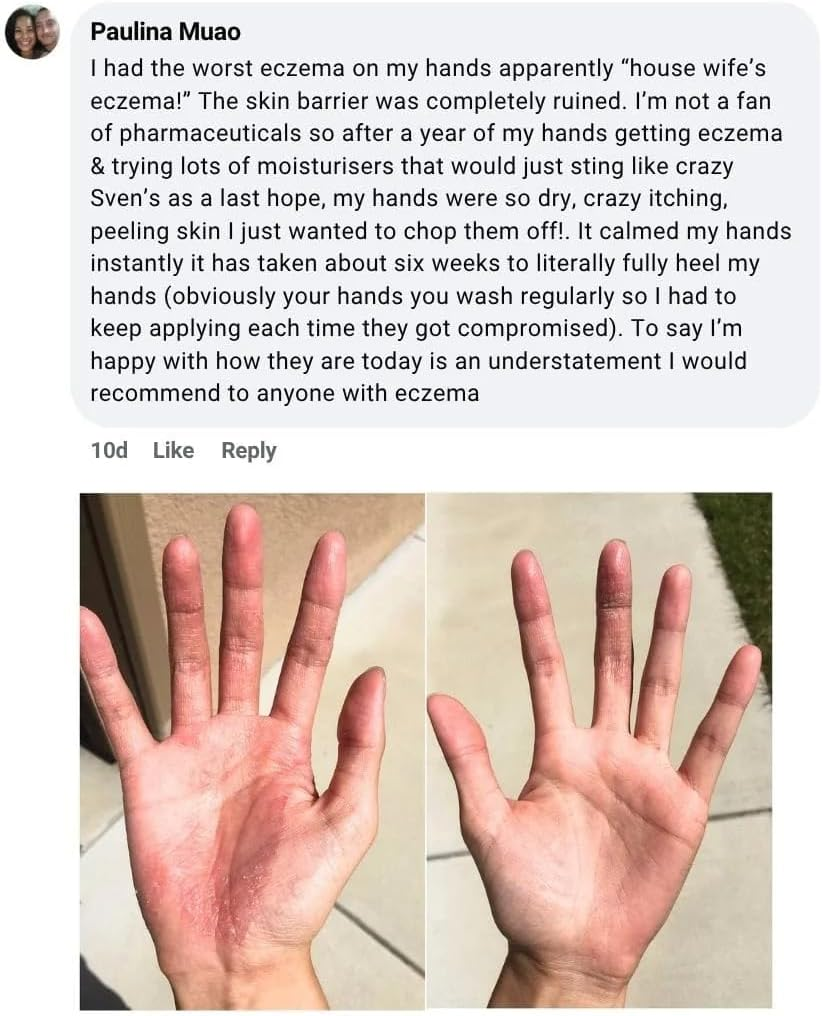 Miracle Manuka Natural Skin Balm (100G) | Botanical Blend with Manuka & Kanuka Oils | Nourishes & Soothes Dry, Sensitive Skin | Made in New Zealand image number 5