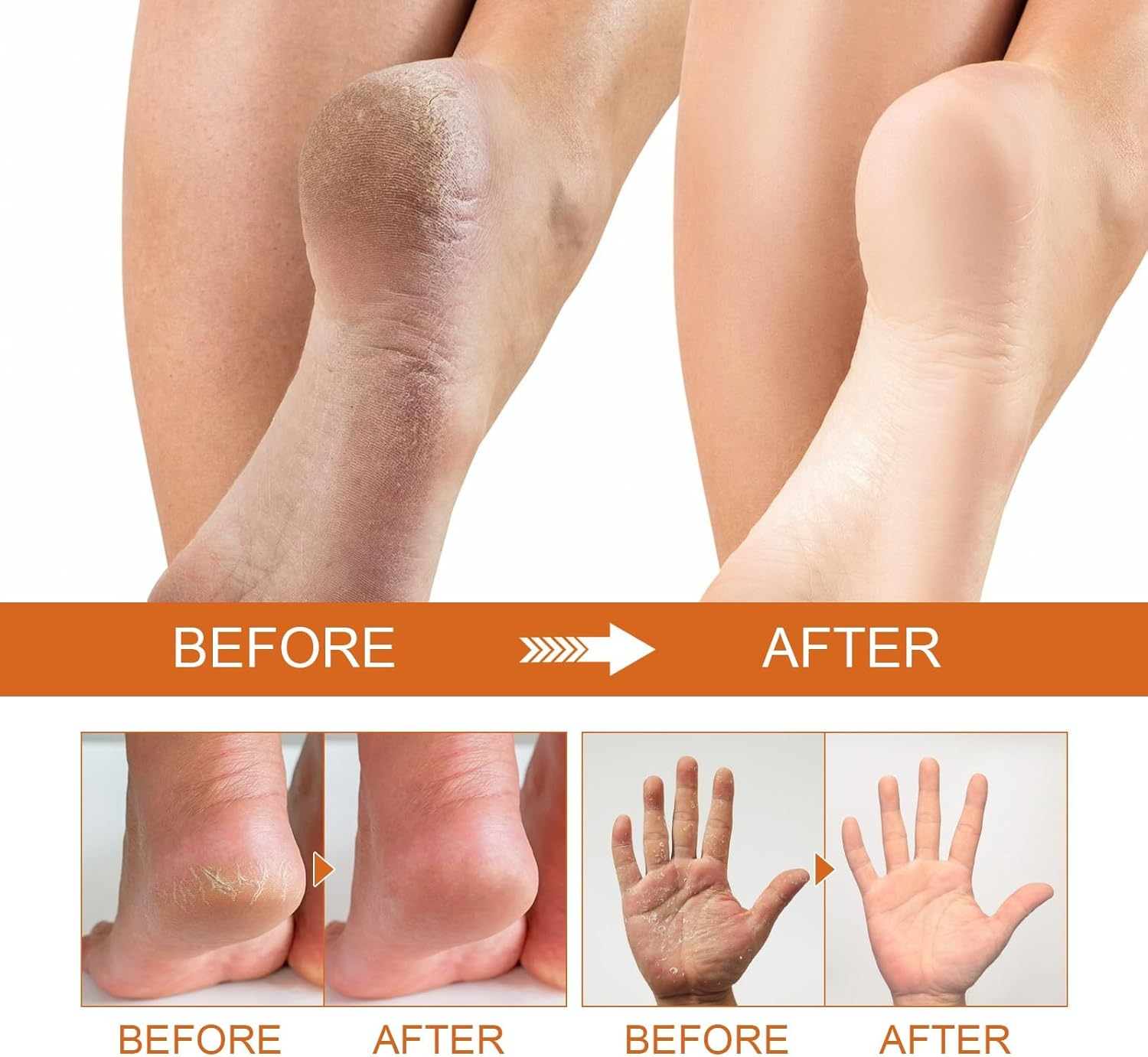 Foot Peeling Spray, Removal Dead Skin, Moisturized and Brighten Skin,Exfoliating Peeling Calluses on Feet, Smoothing Dry & Cracked Feet, Multi - Use for Hands & Joints,Knee,Ankle,Elbow (1PCS) - 4Pcs image number 2