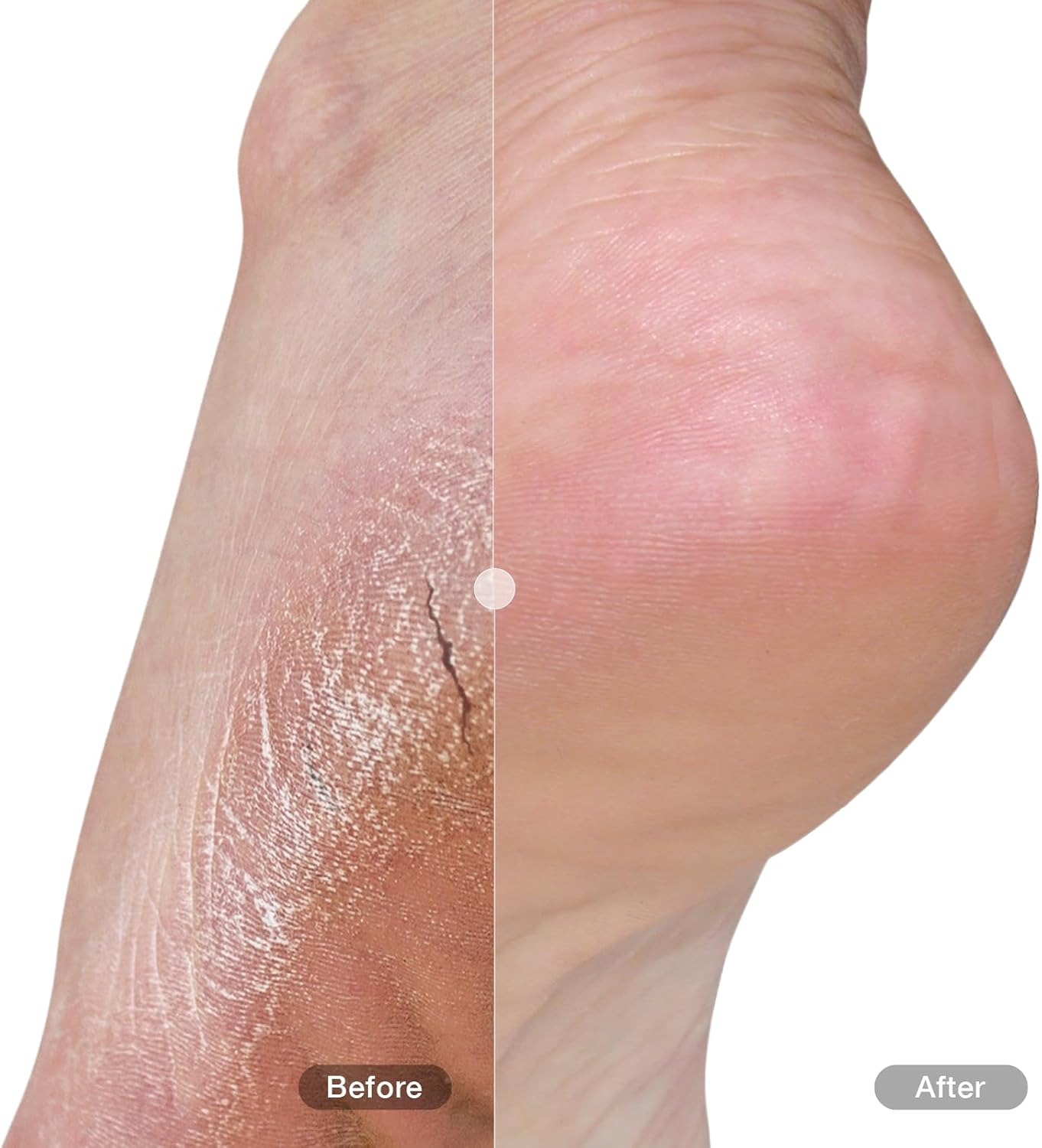 DU&rsquo;IT Foot & Heel Balm plus Foot Cream 75G image number 2