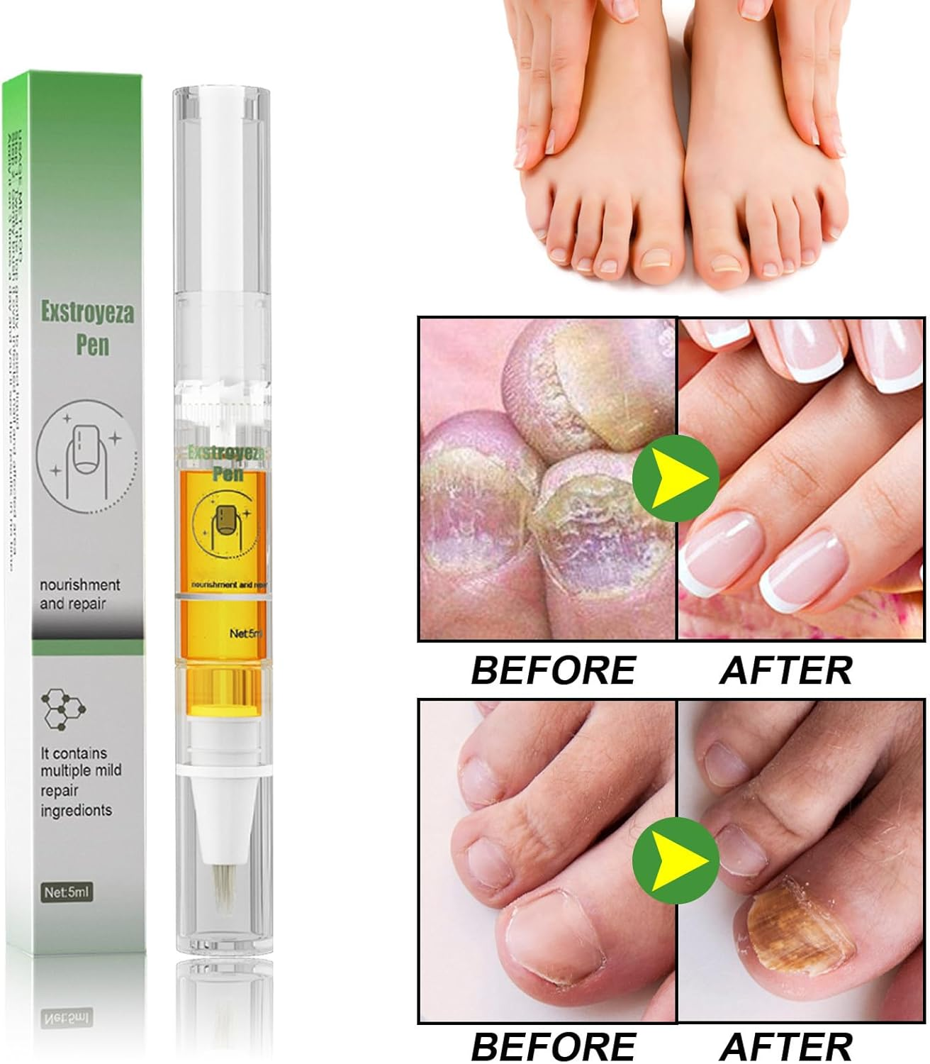 Nail Repair Pen, Toenail Extra Strength Pen &ndash; Solution for Damaged Nails with Brush Applicator, Clear, Fast‑Drying Formula image number 6