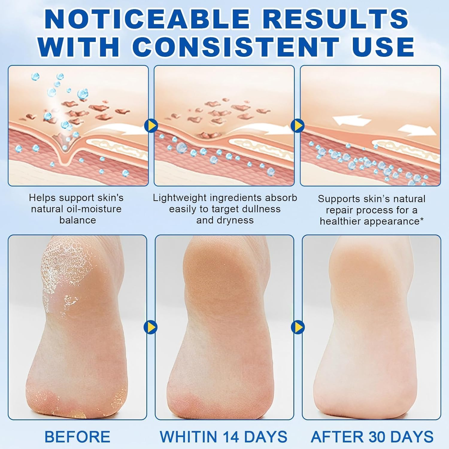 60% Urea with 2% Salicylic Acid Urea Foot Care Stick, Foot Cream Moisturizer for Dry Cracked Feet, Knees, Elbows, Hands,Moisturizes and Hydrates the Dry Skin,Callus Remover & Skin Softener