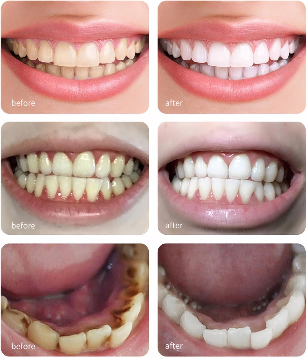 Coconut Oil Pulling Mouthwash with Mentha Haplocalyx Oil, 237Ml &ndash; Promotes Fresh Breath, Healthy Teeth & Gums image number 5