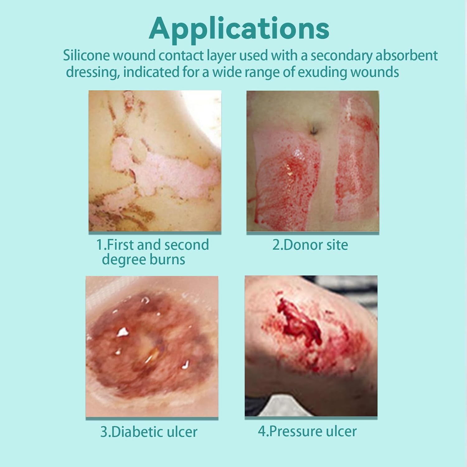 Dimora Silicone Wound Contact Layer, Adaptic Non-Adhering Dressing, Transparent Wound Dressing Pads, 3In X 4In (7.5Cm X 10Cm), 10 Pcs image number 2