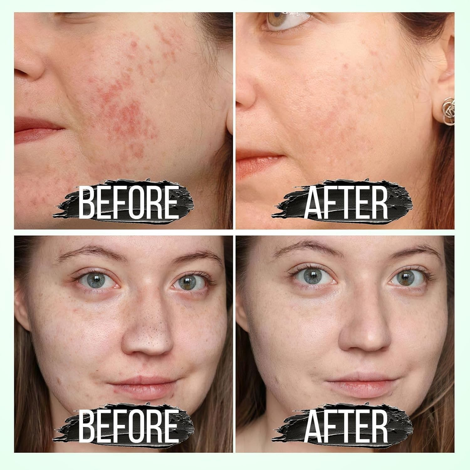 Blackhead Remover Mask - for Women and Men - Activated Charcoal Peel off Face Mask - Deep Pore Cleaner Nose Blackhead Remover Pore Release - Black Head Remover for Face image number 6