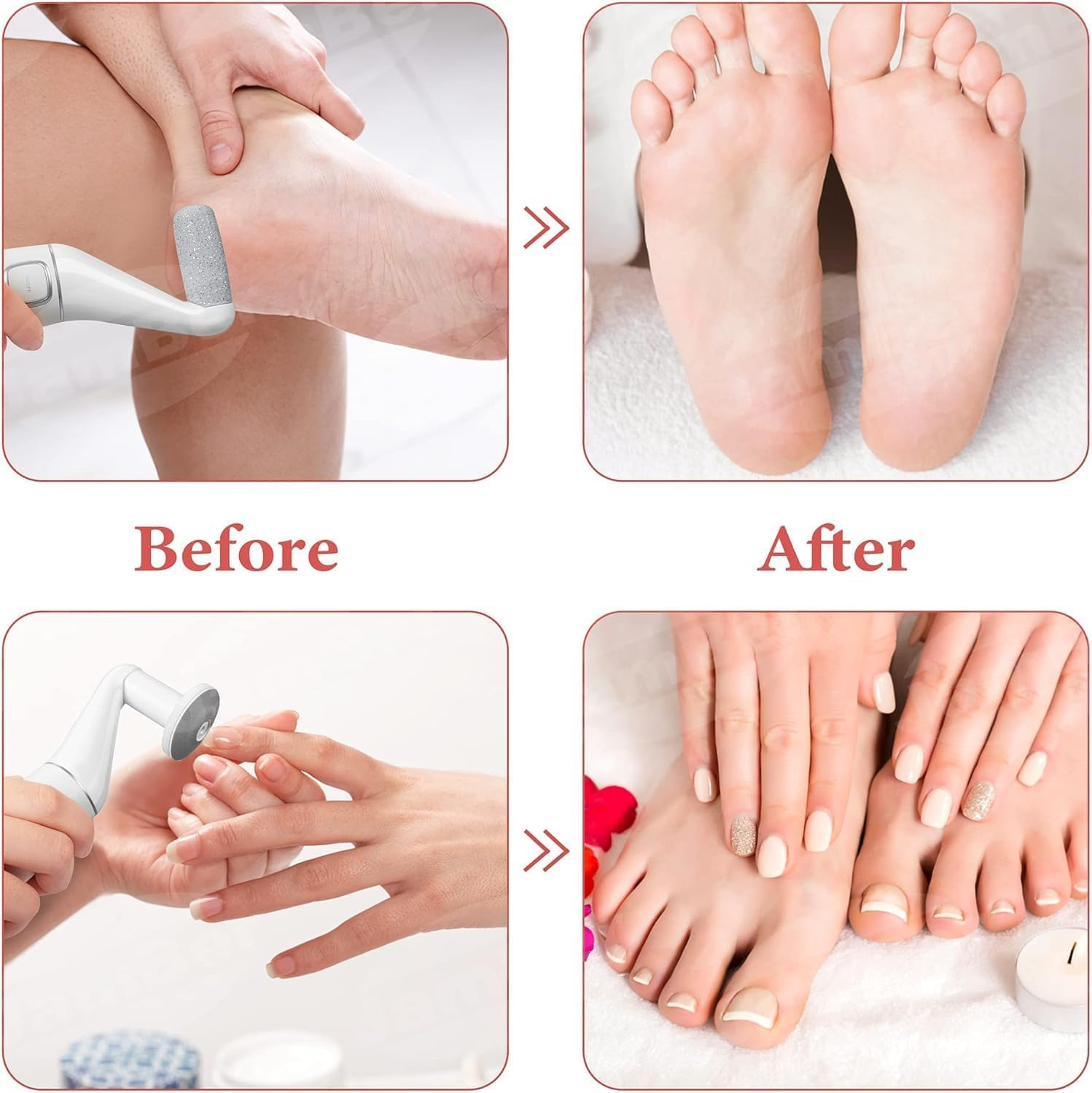 Electric Care Pedicure Foot File Hard Dead Skin Callus Remover Foot Grinder image number 6