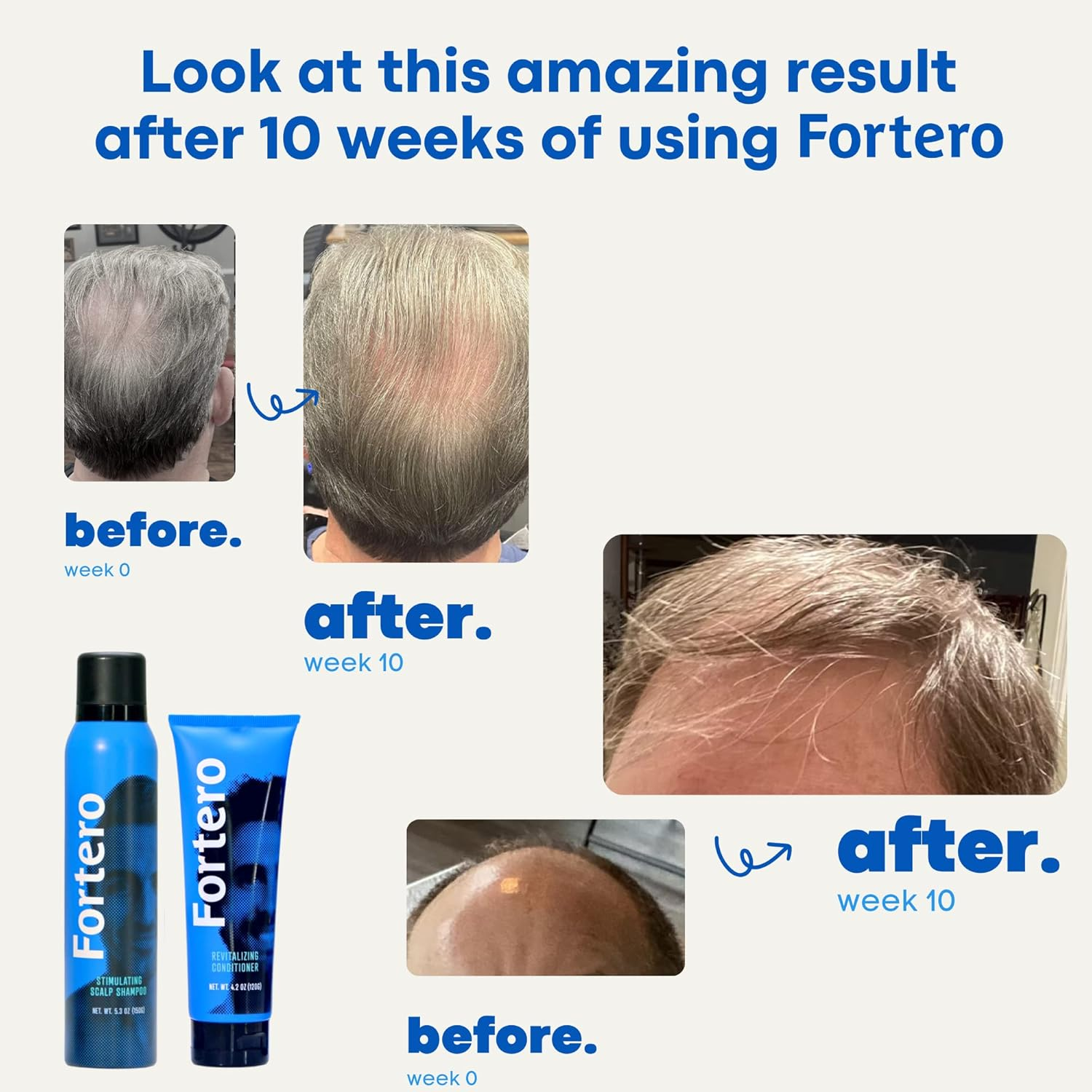 Fortero Hair Growth Conditioner - Hair Thickening Products for Women & Men &ndash; Hydrate Hair and Scalp, Promote Hair Growth - Sulfate Free, for All Hair Types (3 Pack) image number 4