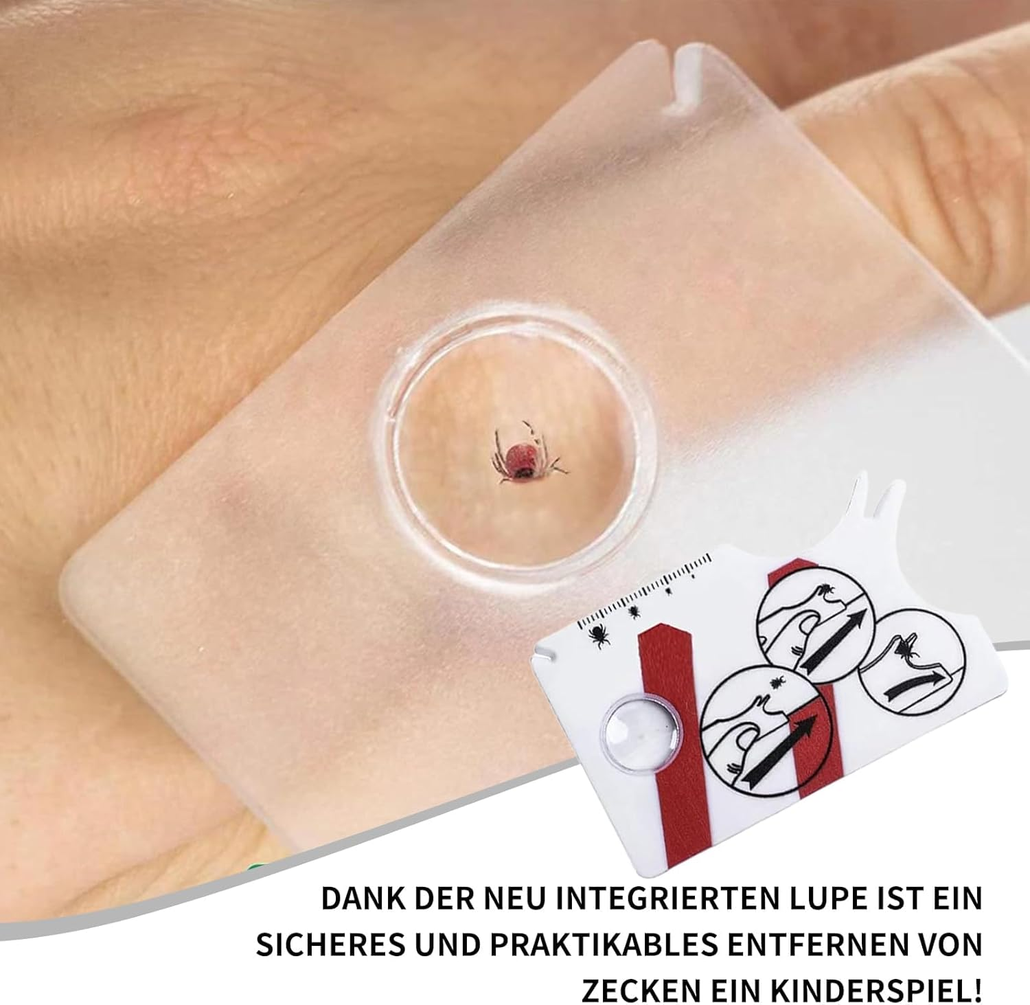 DEFIYEAR Pack of 2 Tick Cards, 3 Set Tick Tweezers for Dogs, Cats, Humans, Quick Cleaning of Ticks, Tick Card for People, Children, Dogs, Cats, with Magnifying Glass image number 2