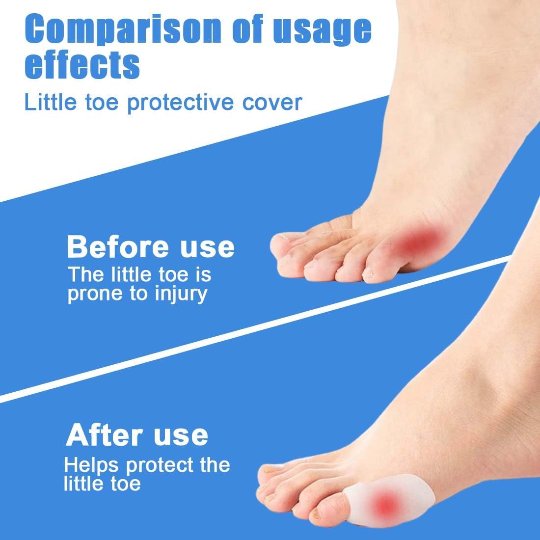 4 Pcs Bunion Corrector Bunion Protector for Relief Pinky Toe Pain Protects the Pinky Toe from Callus Blisters and Corns Unisex, Foot Care
