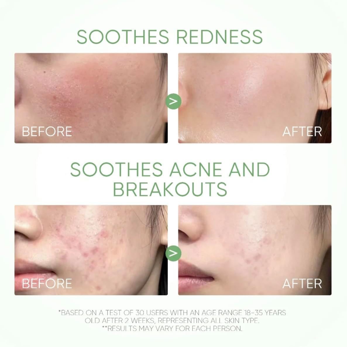 Skintific Mugwort Acne Clay Mask Stick image number 6