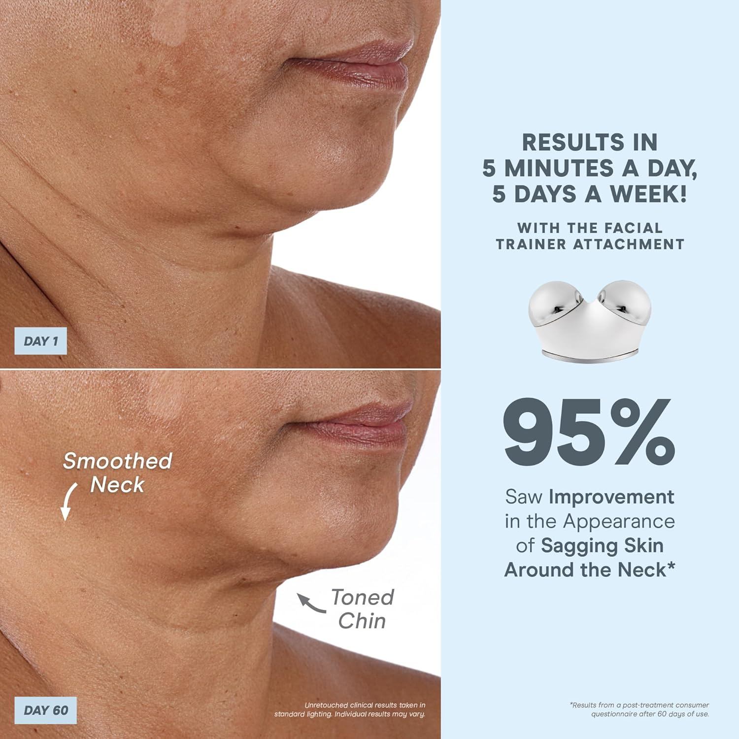 Nuface Advanced Facial Toning Kit, Trinity Facial Trainer Device + Hydrating Leave-On Gel Primer, Skin Care Device to Lift Contour Tone Skin + Reduce Look of Wrinkles, At-Home System image number 2