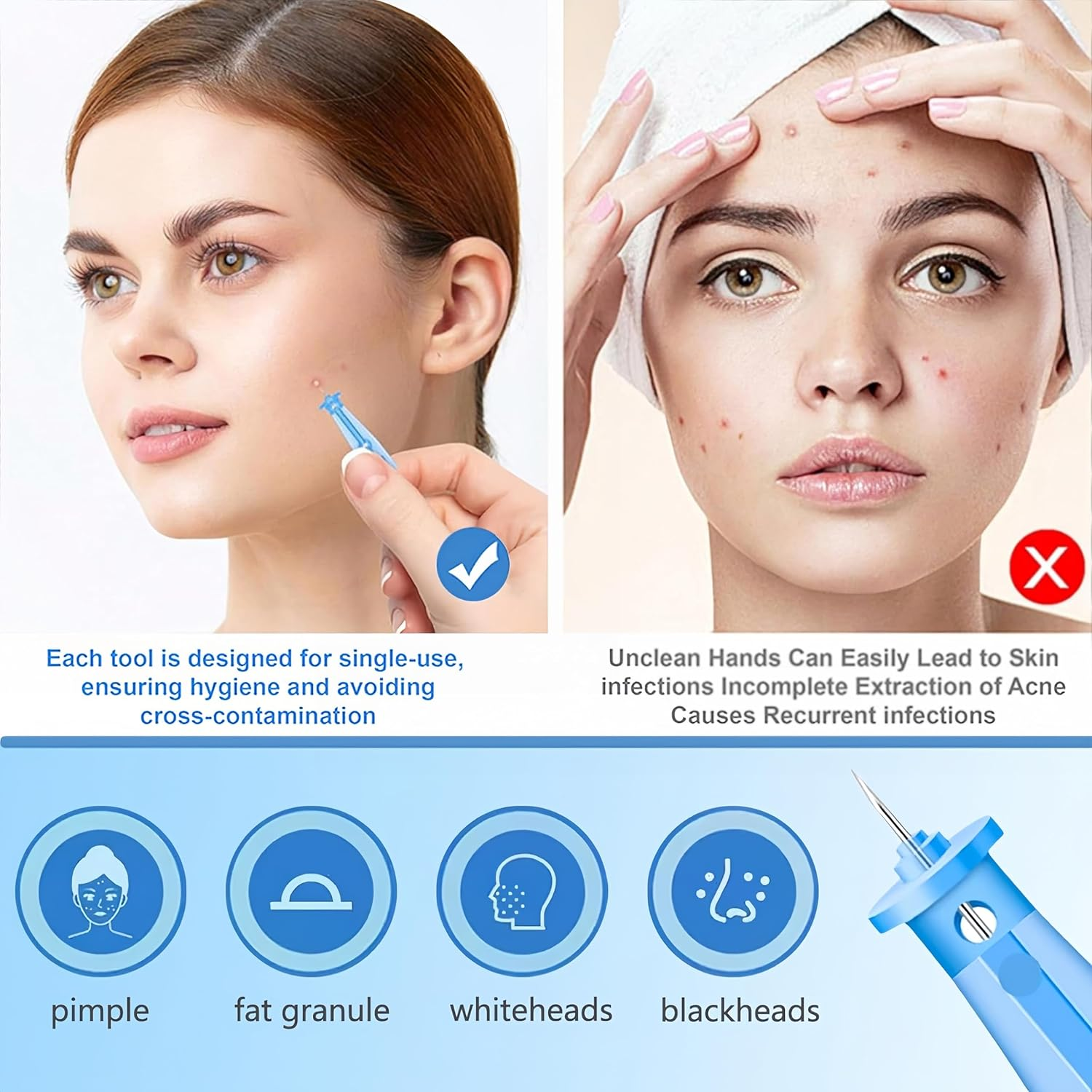 Febohao Blackhead Remover Tool 50Pcs Pimple Popper Kit Skin Care Acne Needle Nose Strips for Blackheads Pimple Extractor Pore Cleaner image number 6