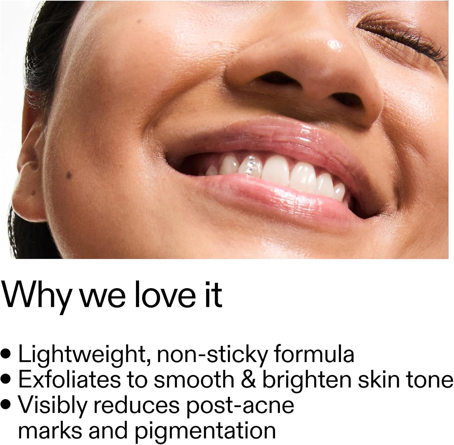 The INKEY List Mandelic Acid Treatment 15 Ml