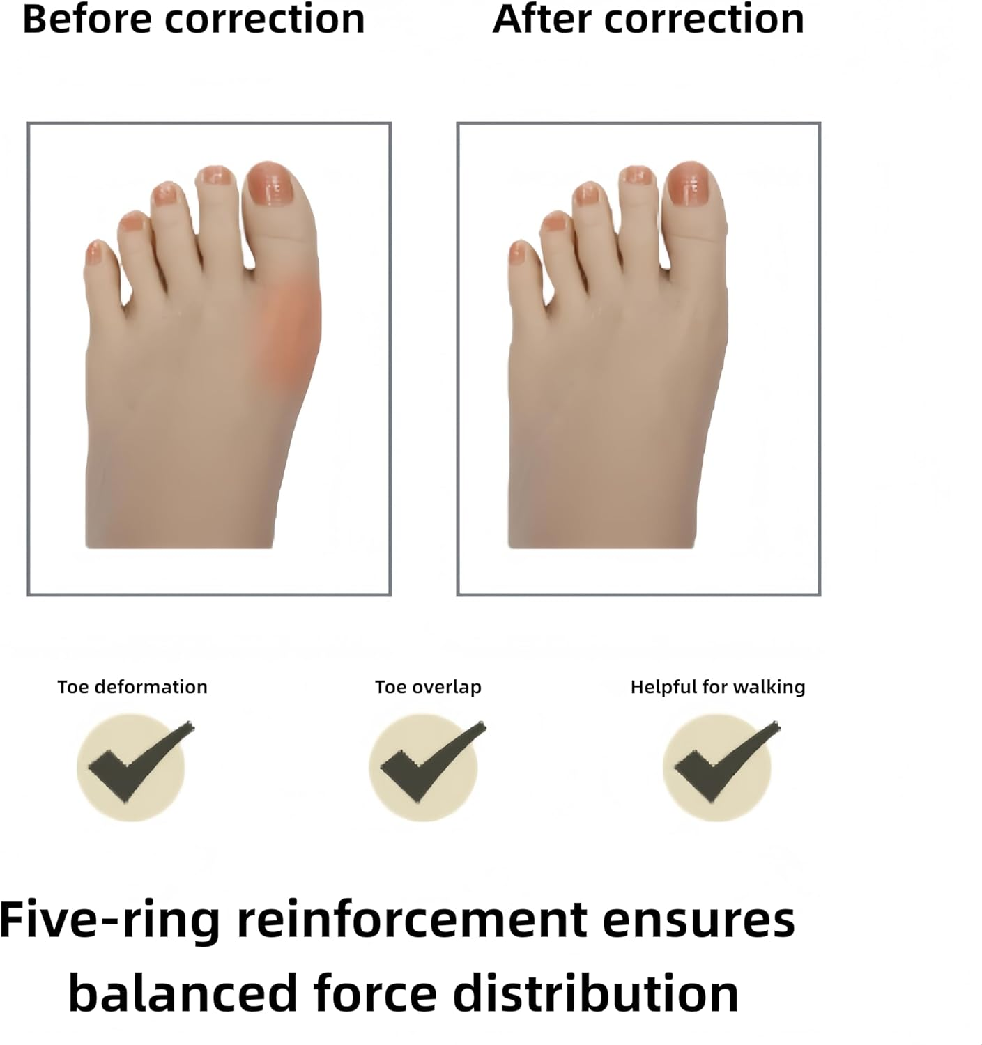 Linjhokbs 2 Pairs Toe Spacers，Correct Bunions and Restore Toes to Their Original Shape/Bunion Corrector Toe Spacer Toe Straightener Toe Stretcher Big Toe Correctors for Women and Men，Skin-Color image number 2