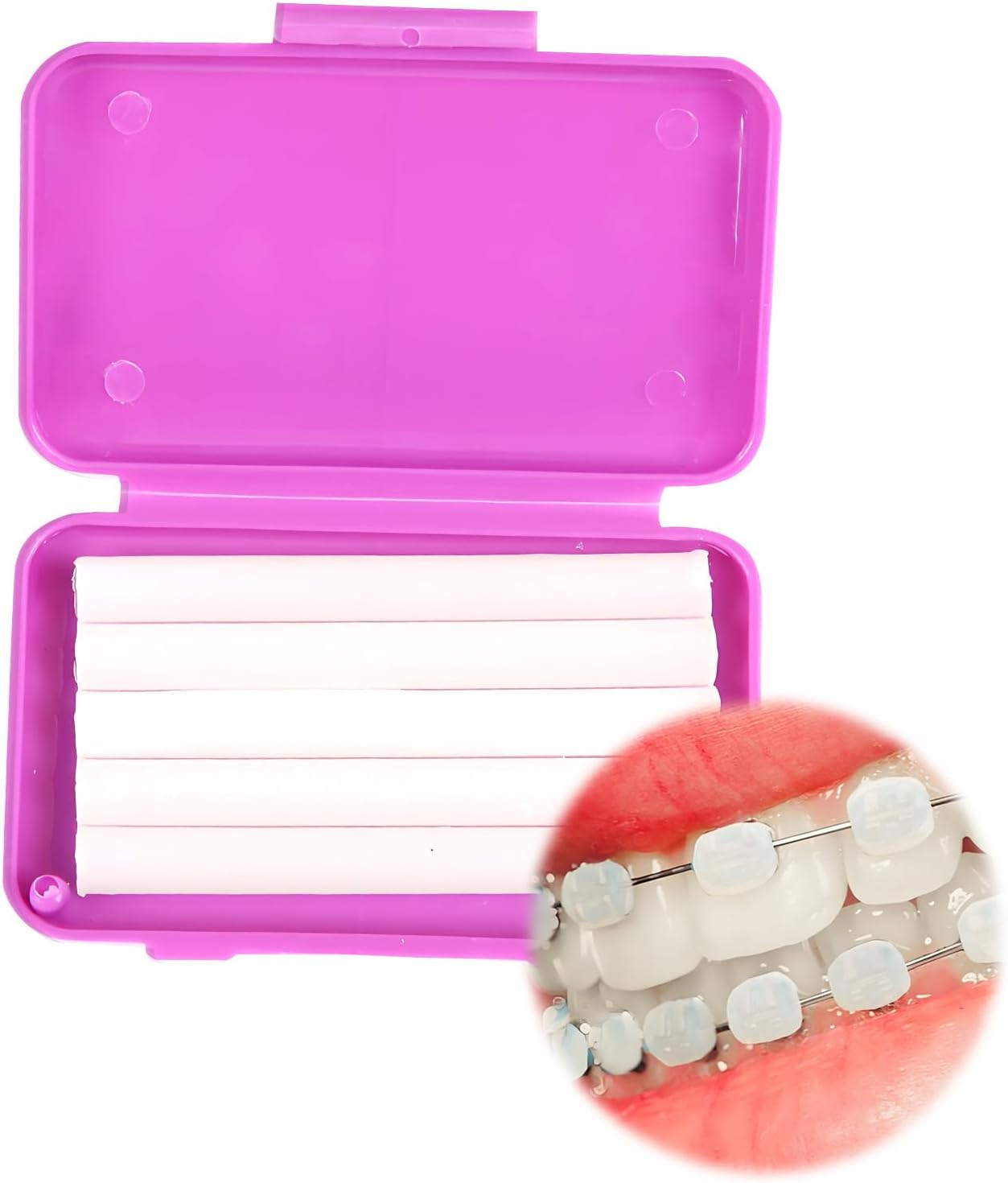 18 Pcs Braces Wax, Dental Wax, Orthodontic Cere Aligners Oral Care for Brackets, Comfort Protection for Braces Wearer, Invisible-Lingers Colorful Portable Boxes