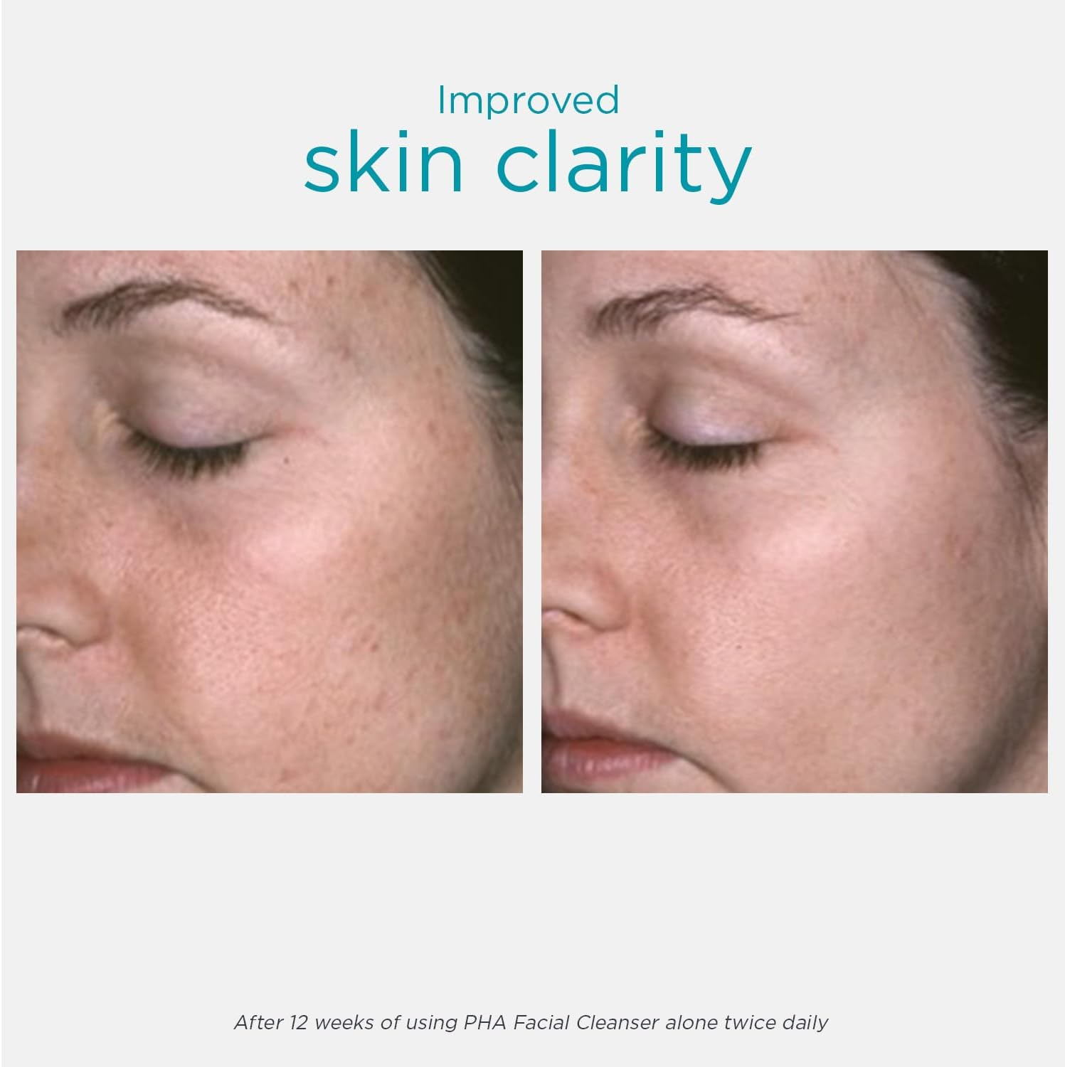 Neostrata Restore Fragrance Free Facial Cleanser 200Ml image number 1