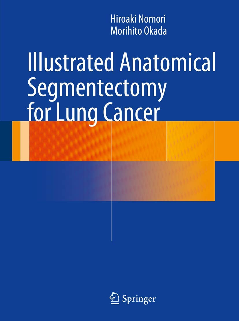 Illustrated Anatomical Segmentectomy for Lung Cancer image number 1