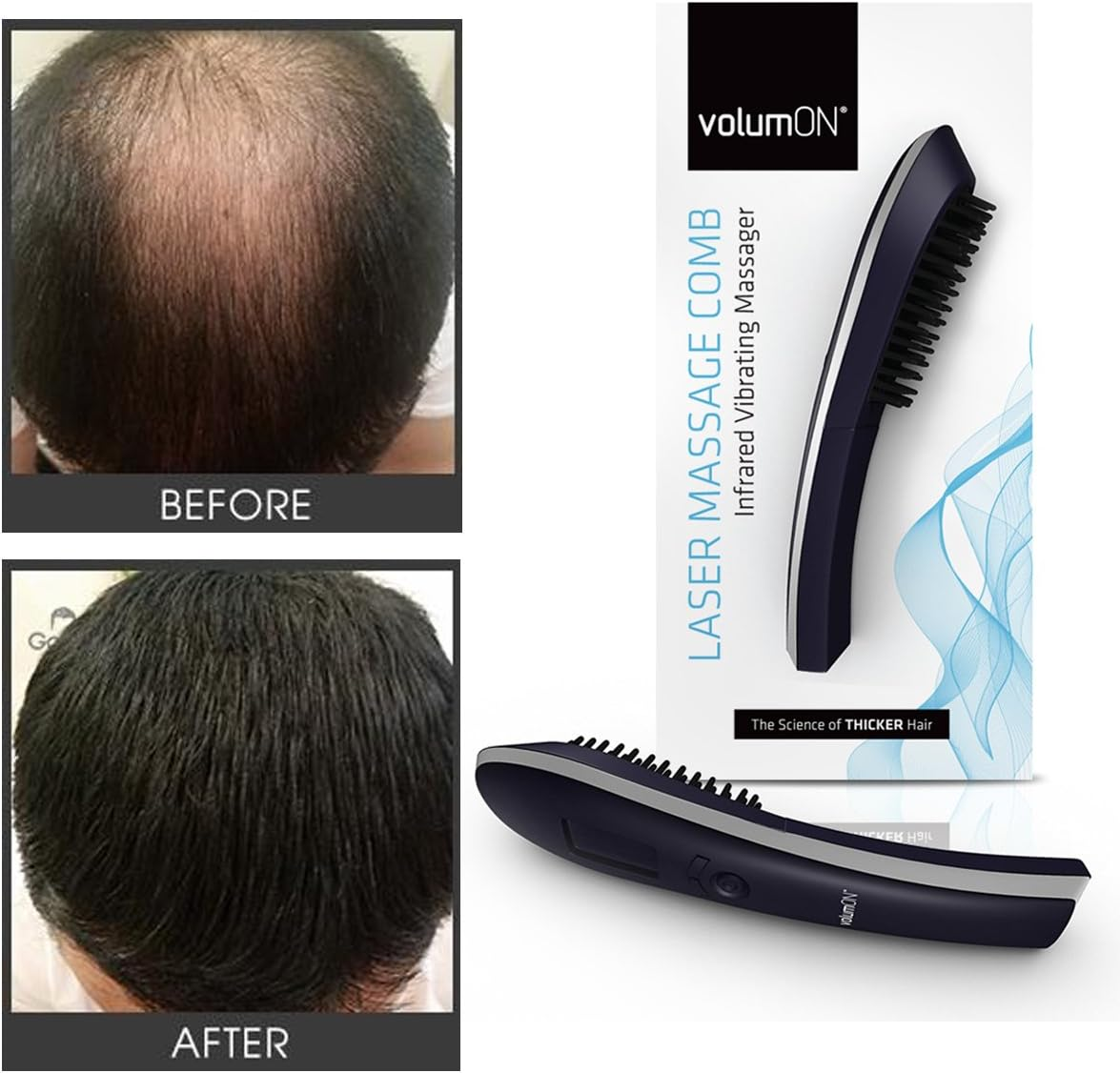 Volumon Electric Laser Massage Comb for Hair Growth Regrowth Hair Thickening & Strengthening with Massager & Infrared & Digital LCD Screen- Daily Home Use image number 5