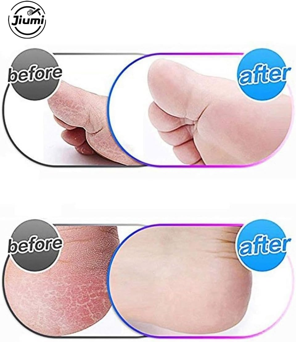 8 Pack Extra Coarse Replacement Rollers for Amope Pedi Refills Electronic Perfect Foot File Pedi Hard Skin Remover Refills Include 1 Nail Brush 1 Clean Brush image number 4