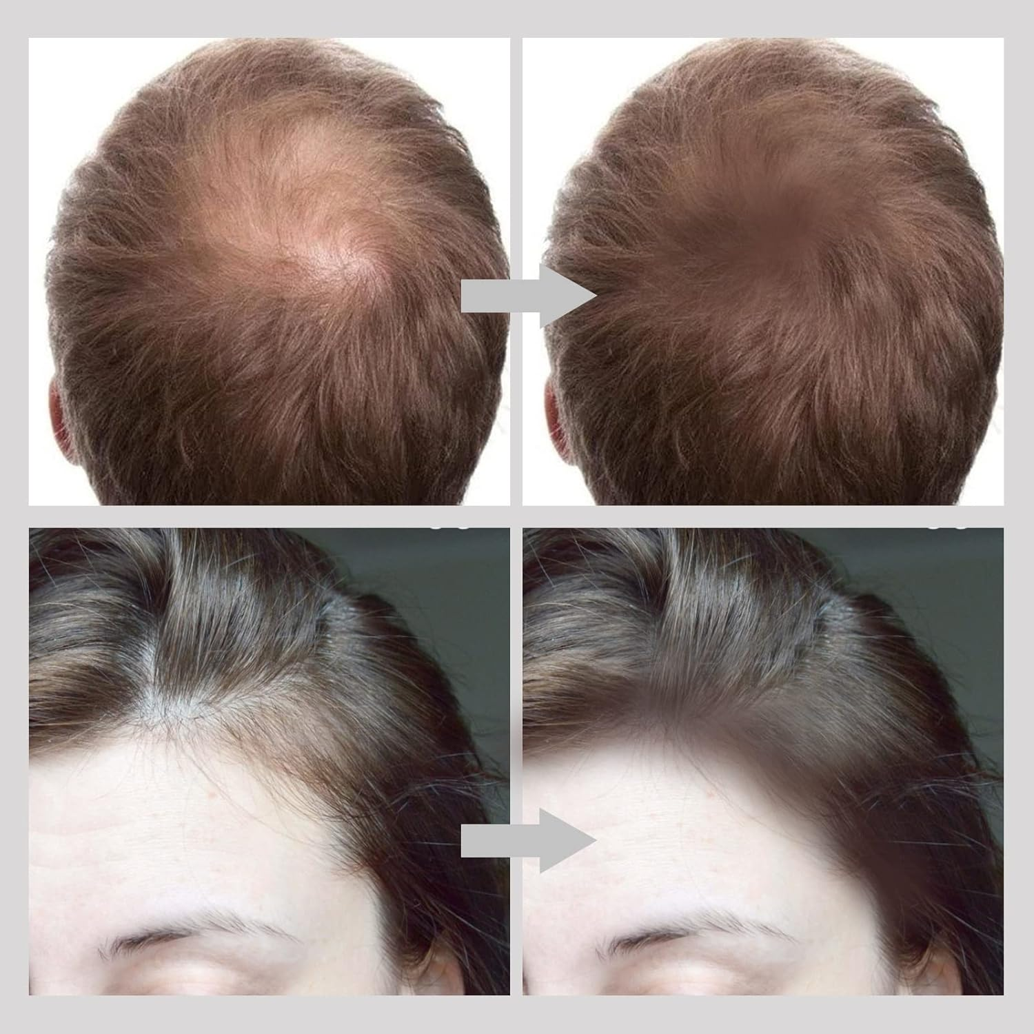 Boobeen Hairline Powder Stick, Hair Color Shadow Powder, Root Touch up for Thinning, Greys Hair, Instantly Cover Up, Multi Contour Concealer Powder