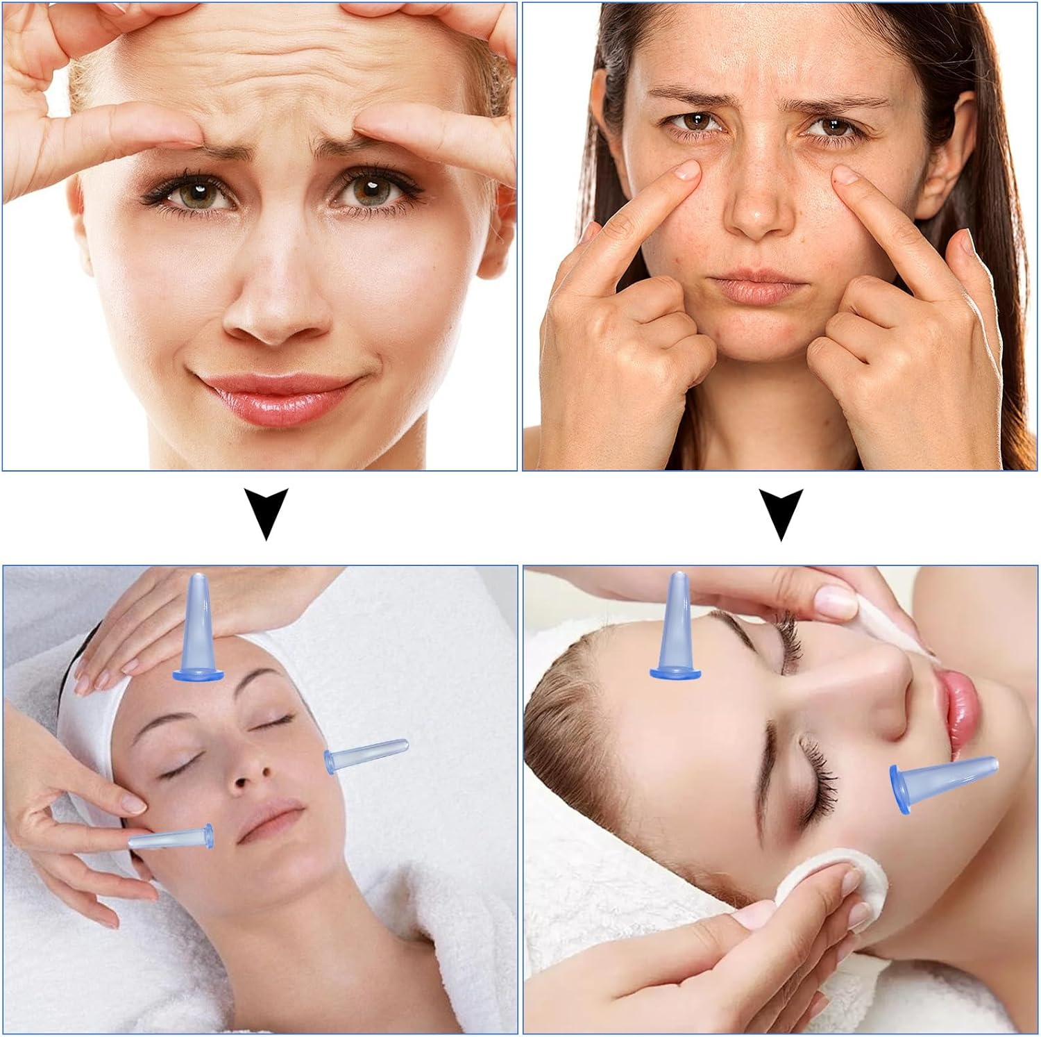 Set of 4 Cupping Glasses, Silicone Cupping Set, Facial Silicone Set, Cupping Glasses, Face Cupping (Blue) image number 5