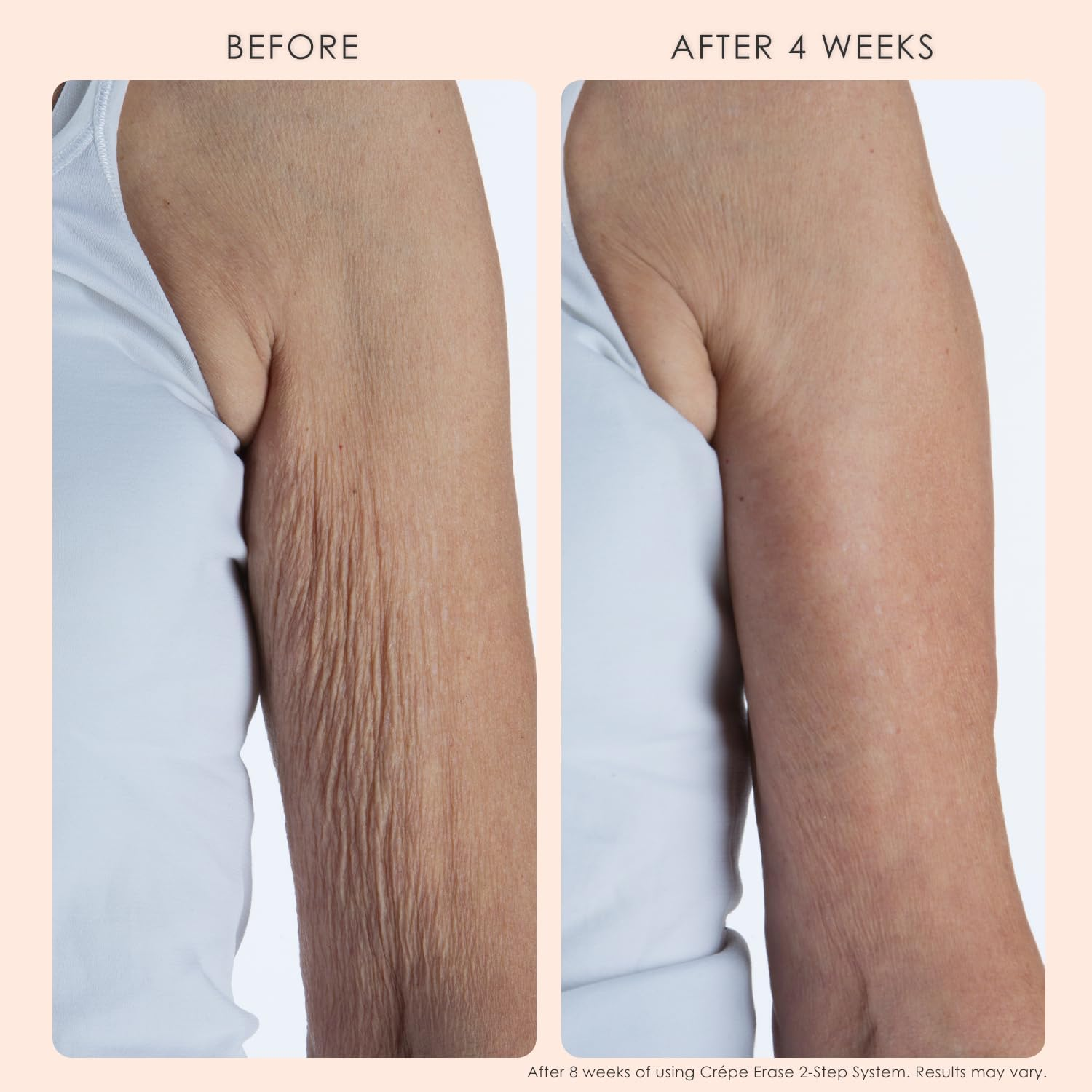 Crepe Erase Advanced, Body Smoothing Pre-Treatment with Trufirm Complex (Packaging May Vary) image number 2