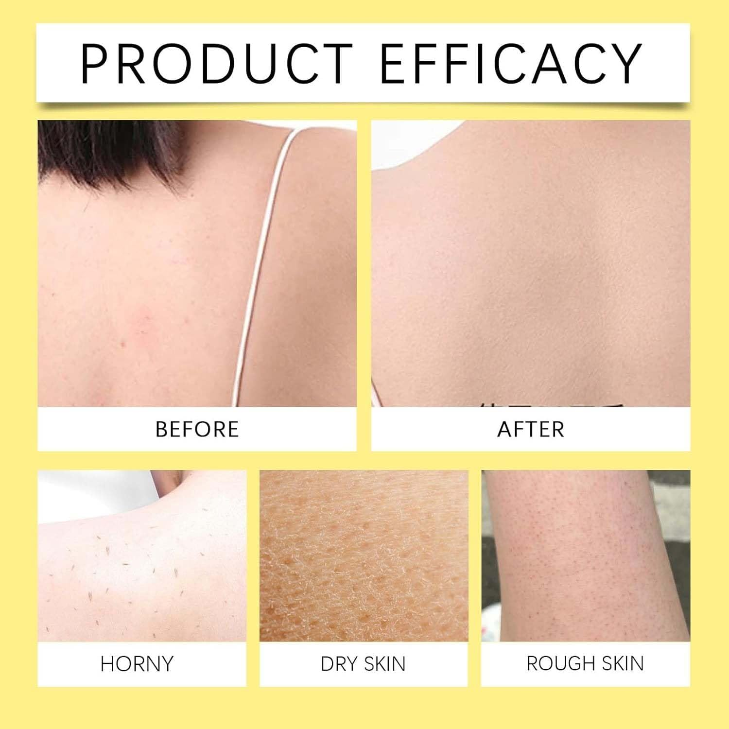 2Pcs Keratin Care Kojic Acid Turmeric Spray,Kojic Acid Turmeric Body Peeling Shot, Gently Exfoliating and Hydration of Skin and Supports Smoother,For Face,Body & Feet image number 4