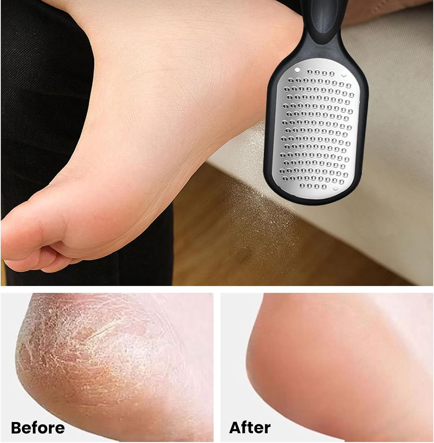 Agwenkui Foot File Callus Remover with Dead Skin Catcher - Foot File Callus Remover Tool for Mess-Free Pedicures, Effective Heel Scraper for Cracked Heel Treatment, Wet Dry Use Feet Rasp (Black) image number 3