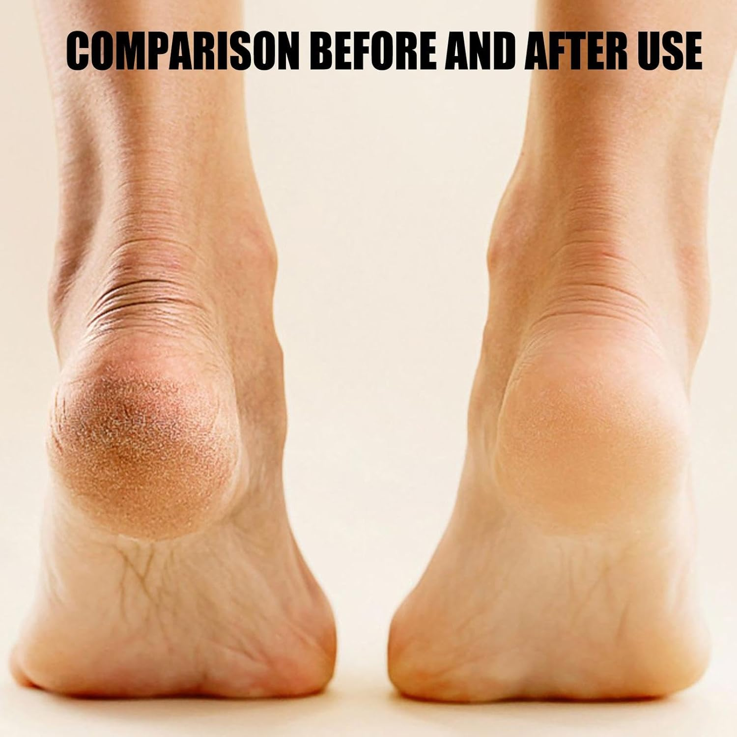 Electric Foot Scrubber File - Hard Skin Remover Foot, Electric Callus Remover Kit | Callus Remover with USB Charging for Dead Skin, Foot Care Tool Foot Scrubber File for Men Women (8.5X7Cm) - Yellow image number 3