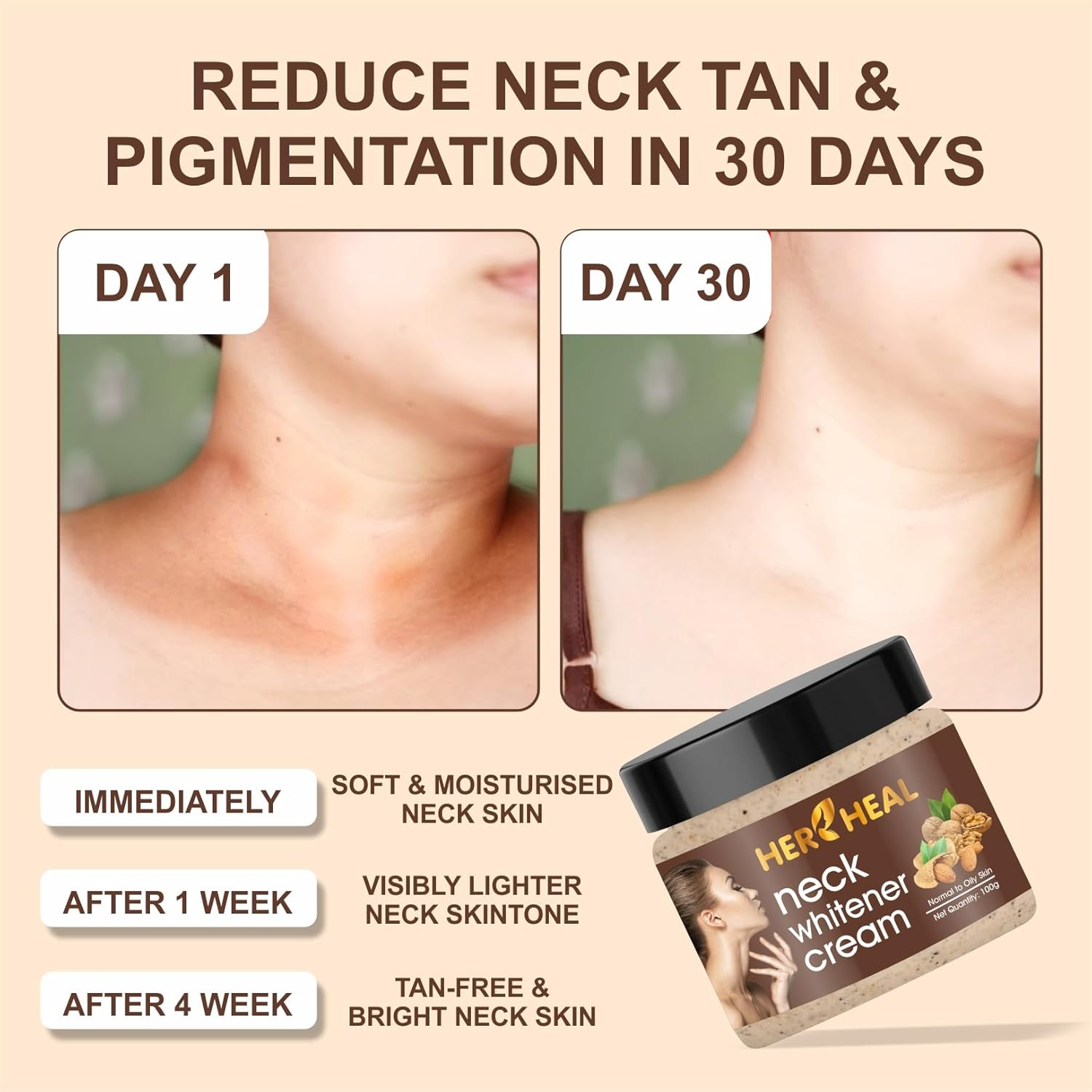 HER HEAL Neck Cream for Acanthosis Nigricans | for Dark Body Parts like Neck, Ankles, Knuckles, Armpits, Thighs, Elbows| Exfoliant 100Gm PACK Of-3(300Gm) image number 5