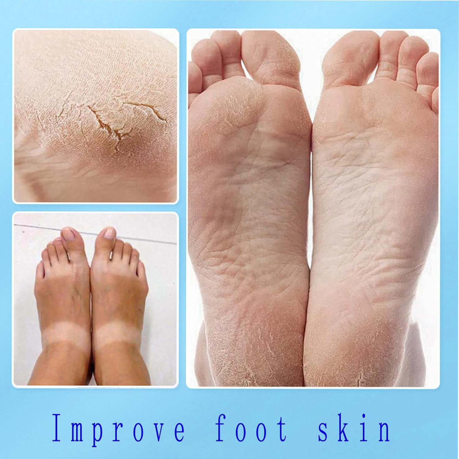 6Pcs Foot Mask, Tender Skin, Moisturizing, Foot Care, Niacinamide Foot Mask image number 3